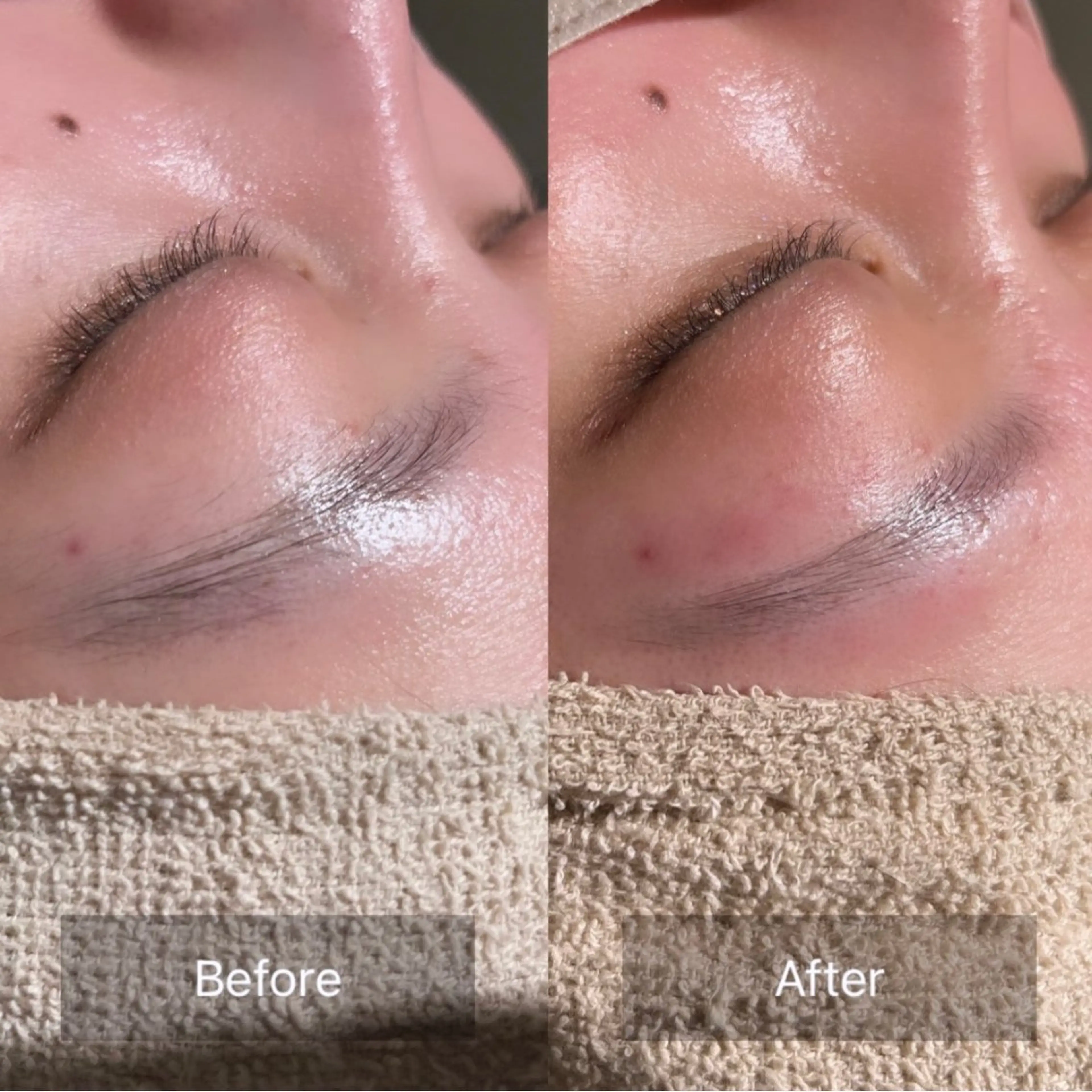 アイブロウ ワックス脱毛 眉カット その他(アイブロウ) for woman所属・森 美優のエステ・リラクイメージ