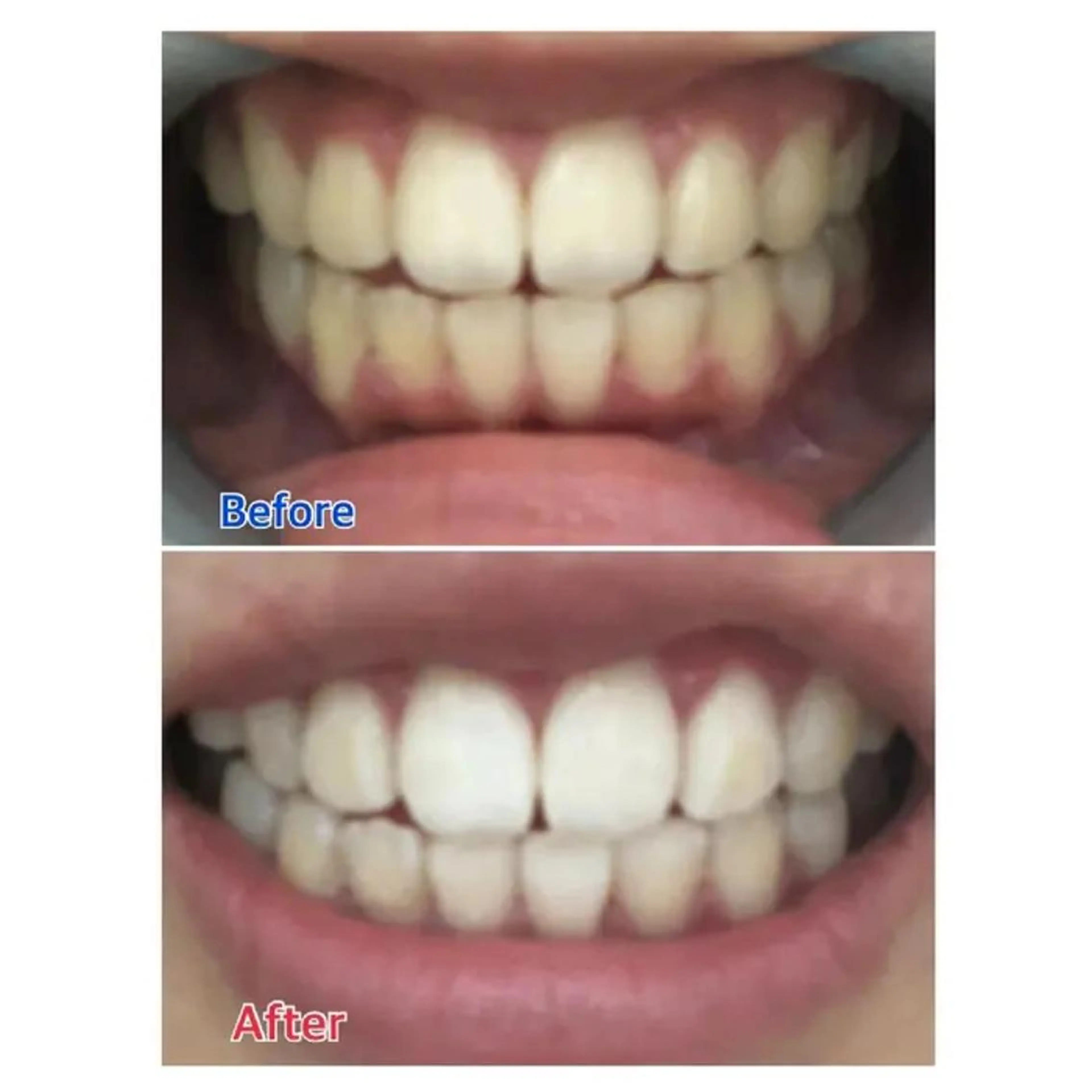 M渋谷 ホワイトニングのエステ・リラクイメージ