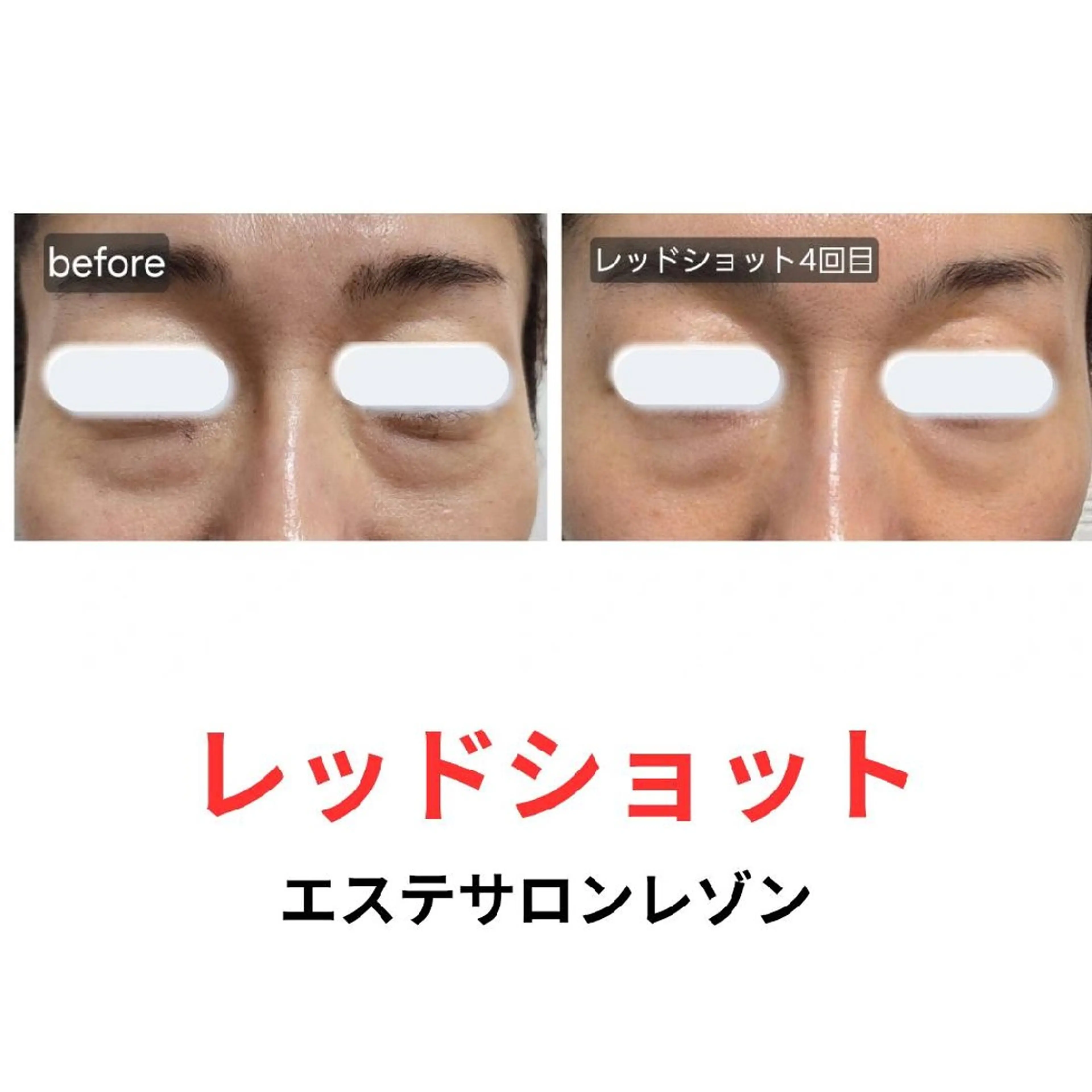 〈ニキビケアサロン〉 レゾン京橋店/ 浅川のエステ・リラクイメージ