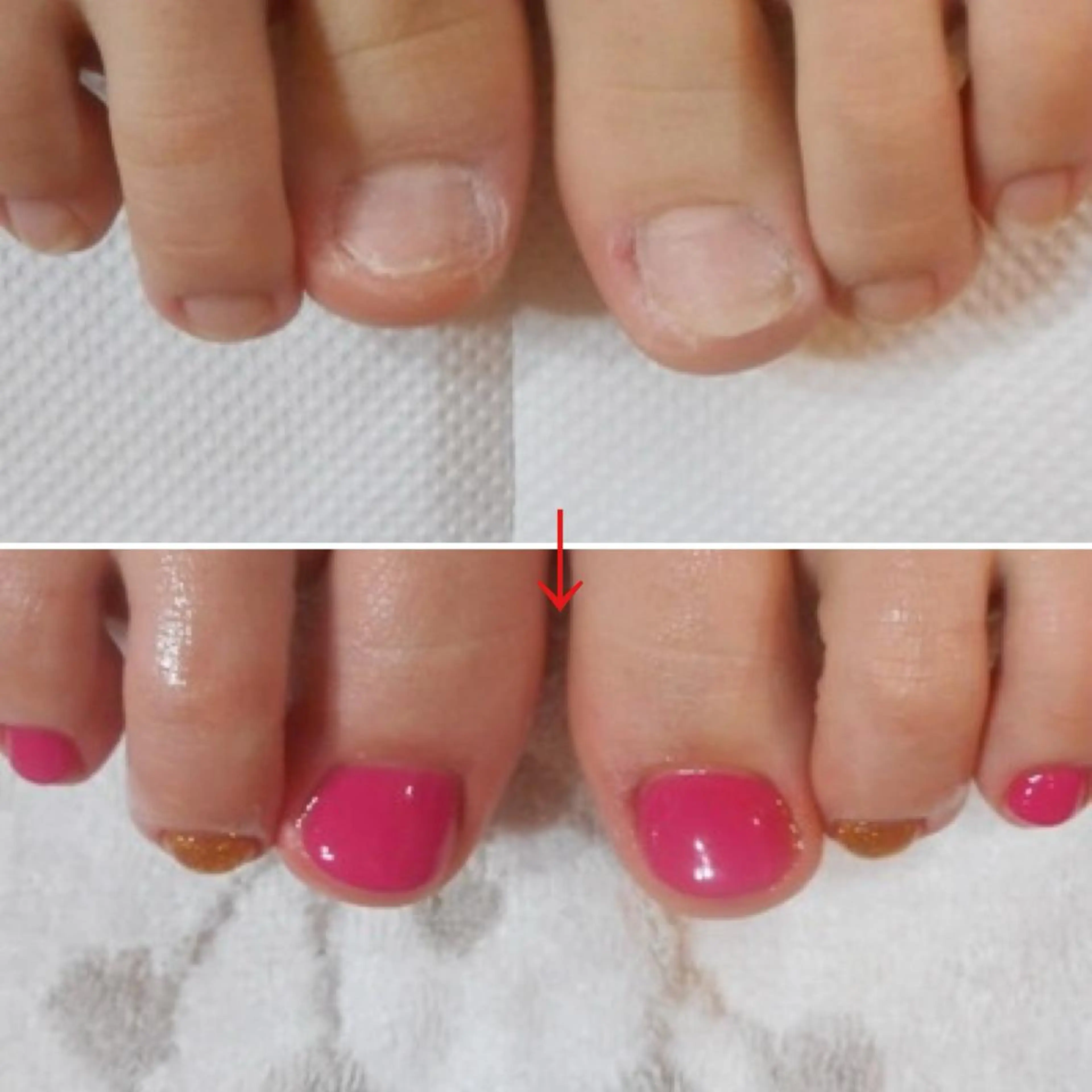 ネイル フットネイル ネイルサロン アリュームのネイルデザイン