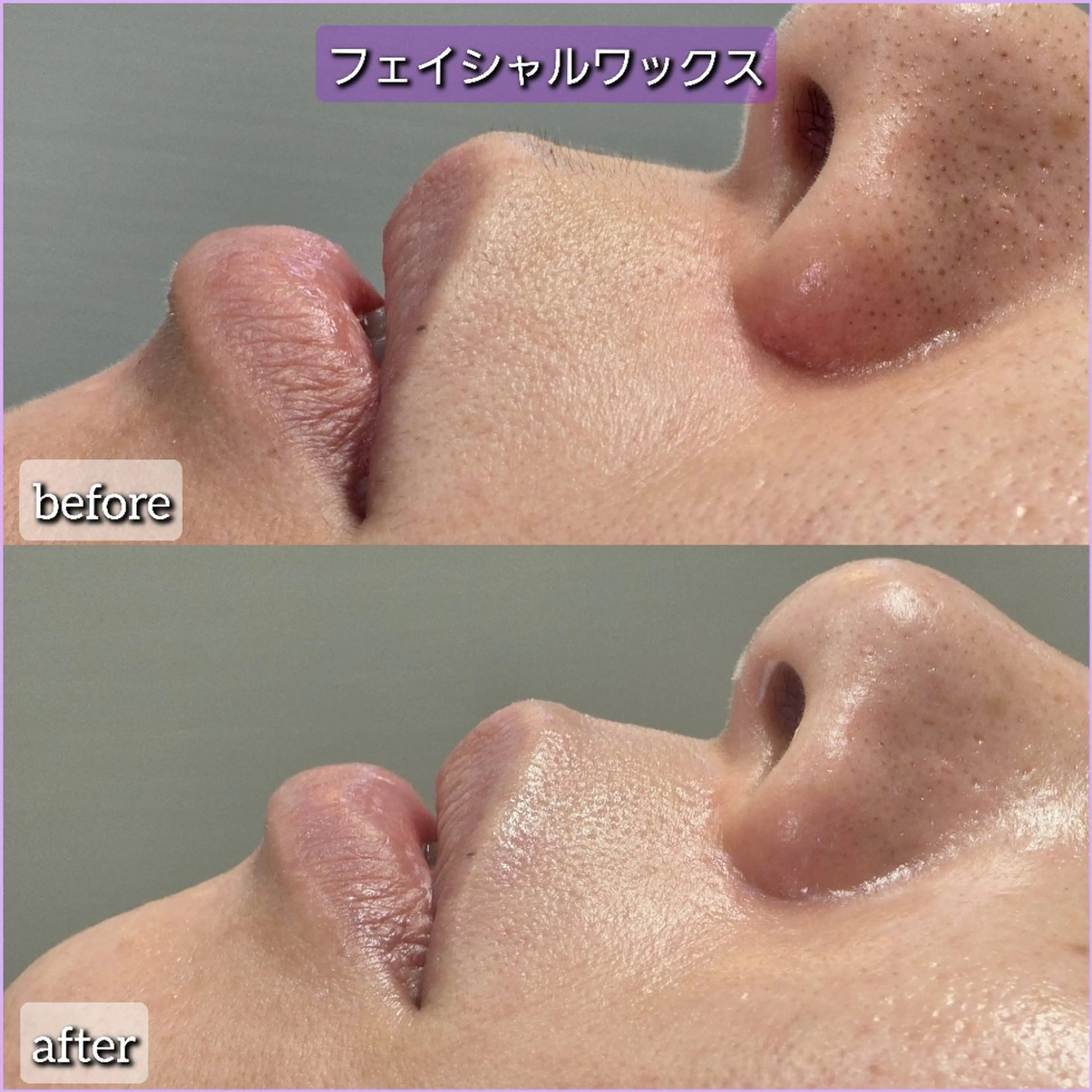 エステ facial salon Lily所属・salon Lilyのエステ・リラクイメージ