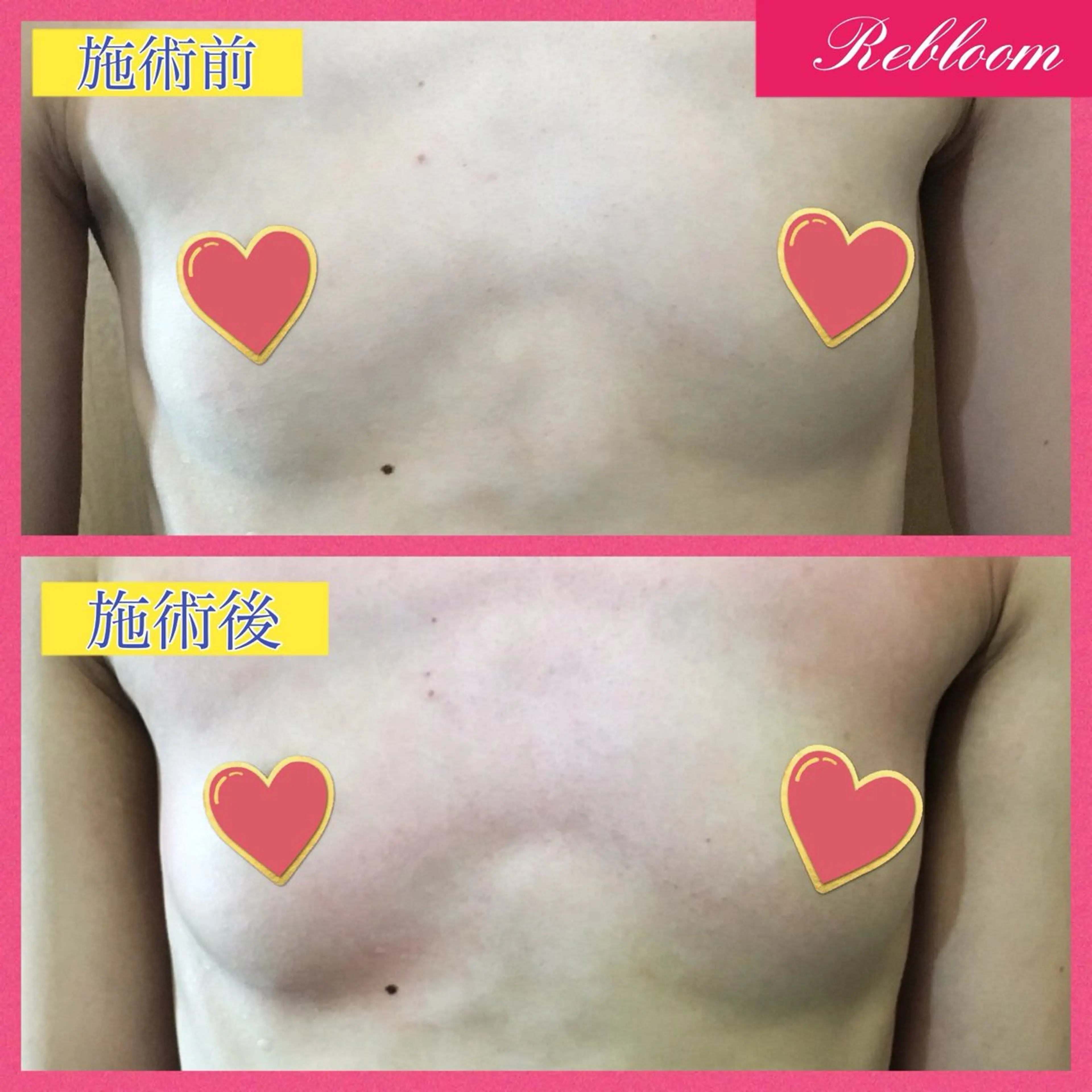 エステ デリケートな悩み解決 Rebloomのエステ・リラクイメージ