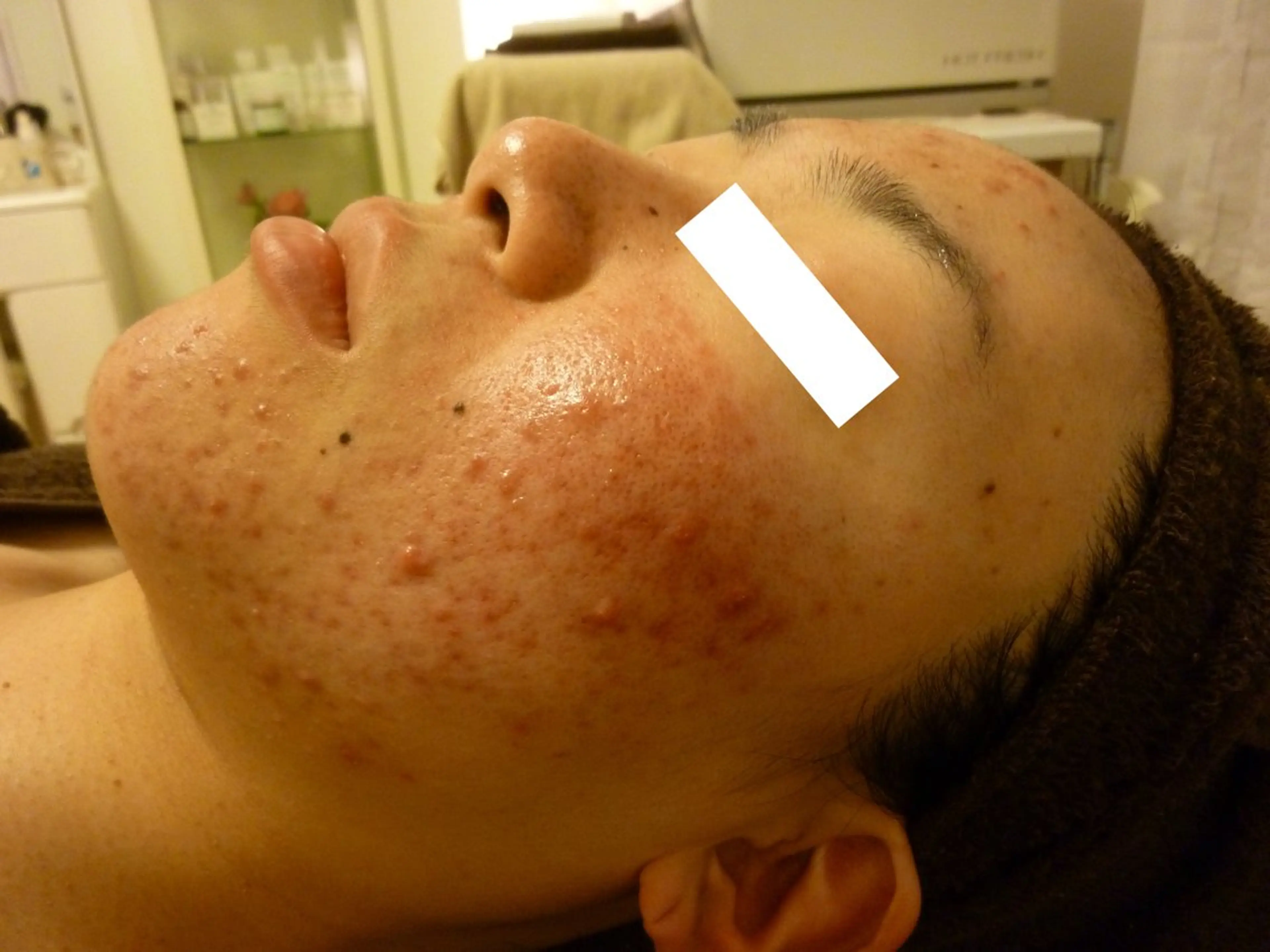 ピーリングサロン シャンテールのエステ・リラクイメージ