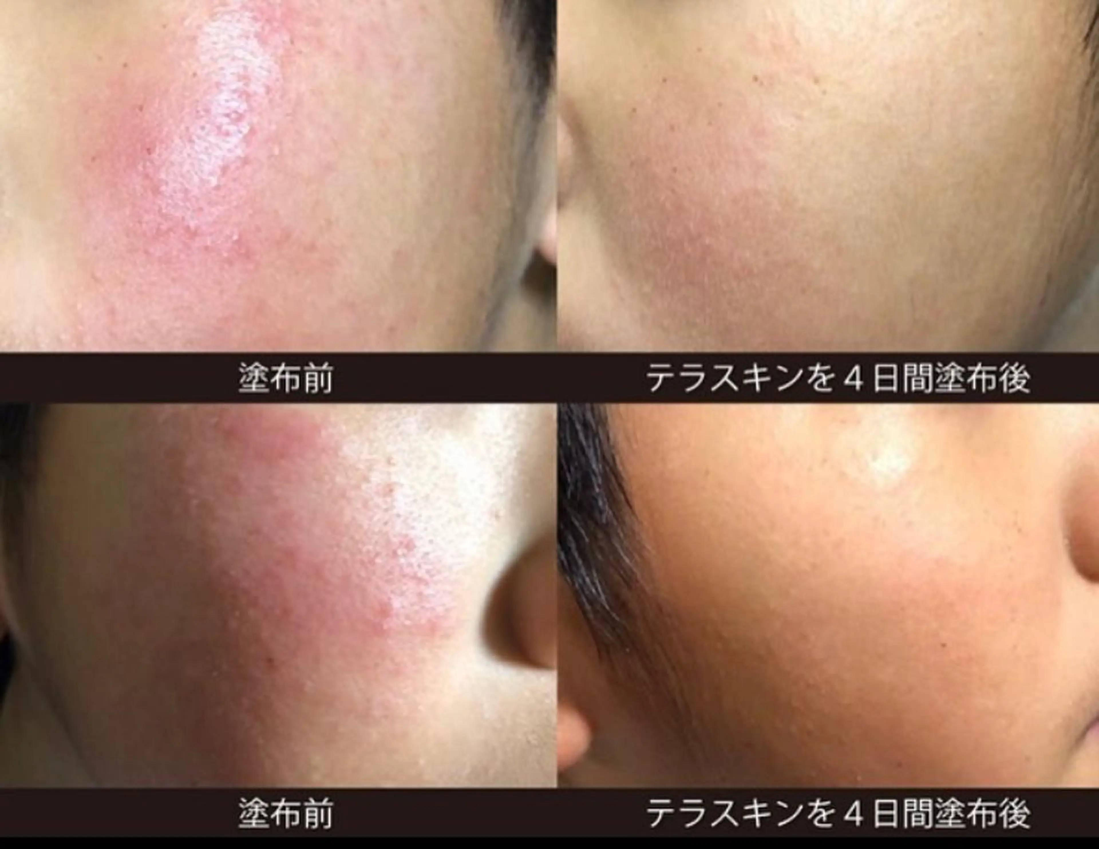 山元 光絵のエステ・リラクイメージ