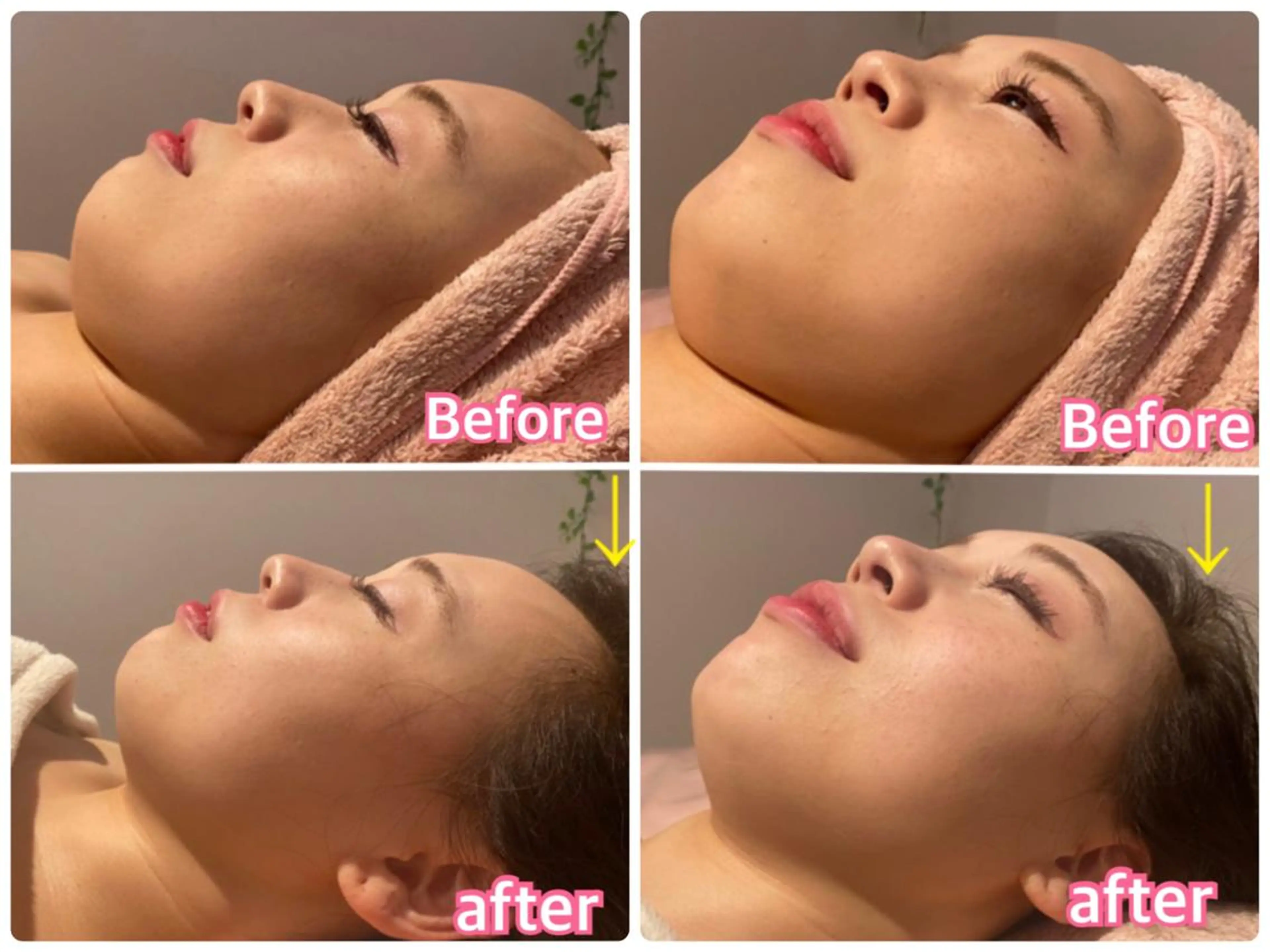 エステ リラク ルシール ユーのエステ・リラクイメージ