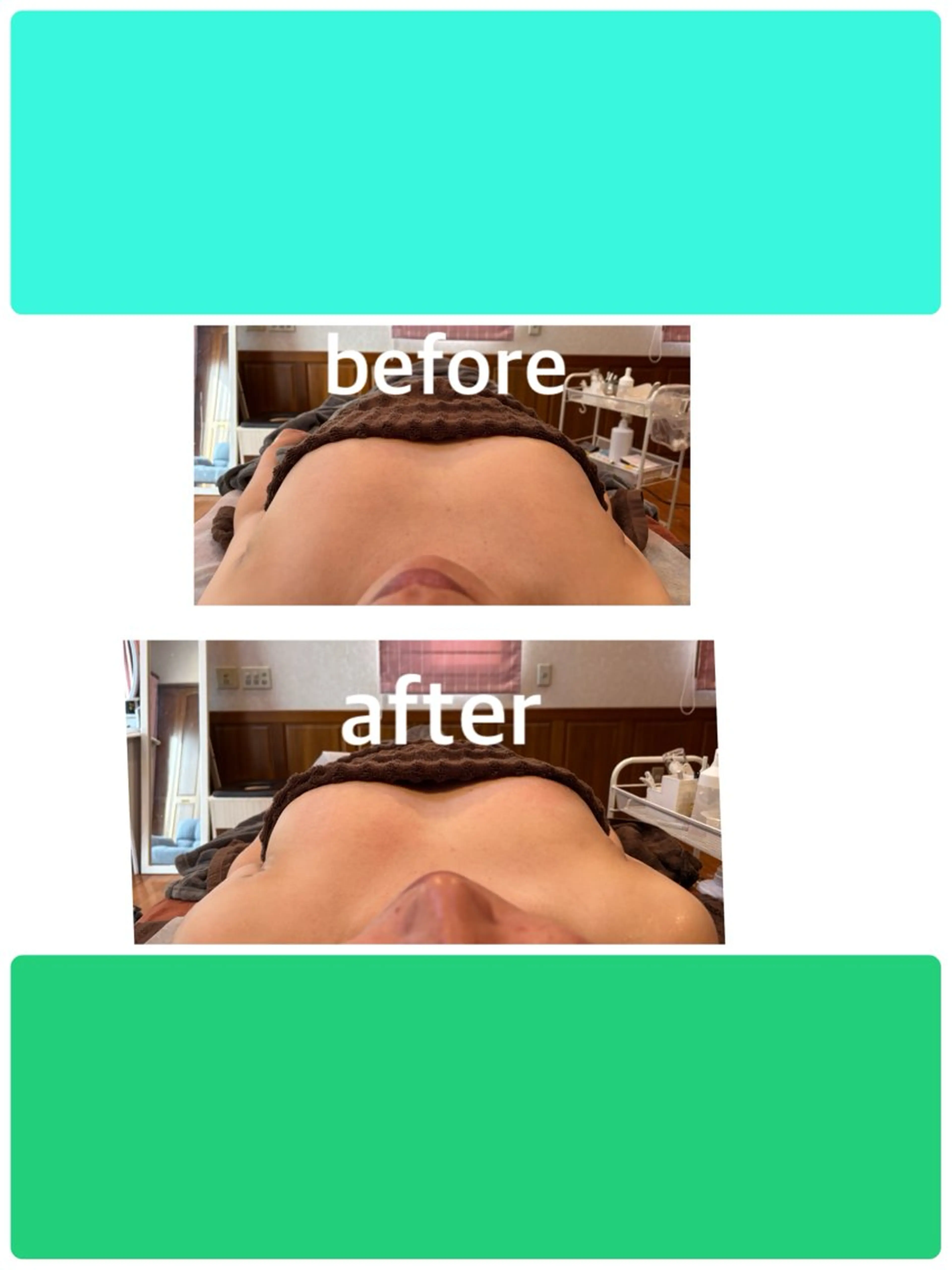 光バストアップの写真