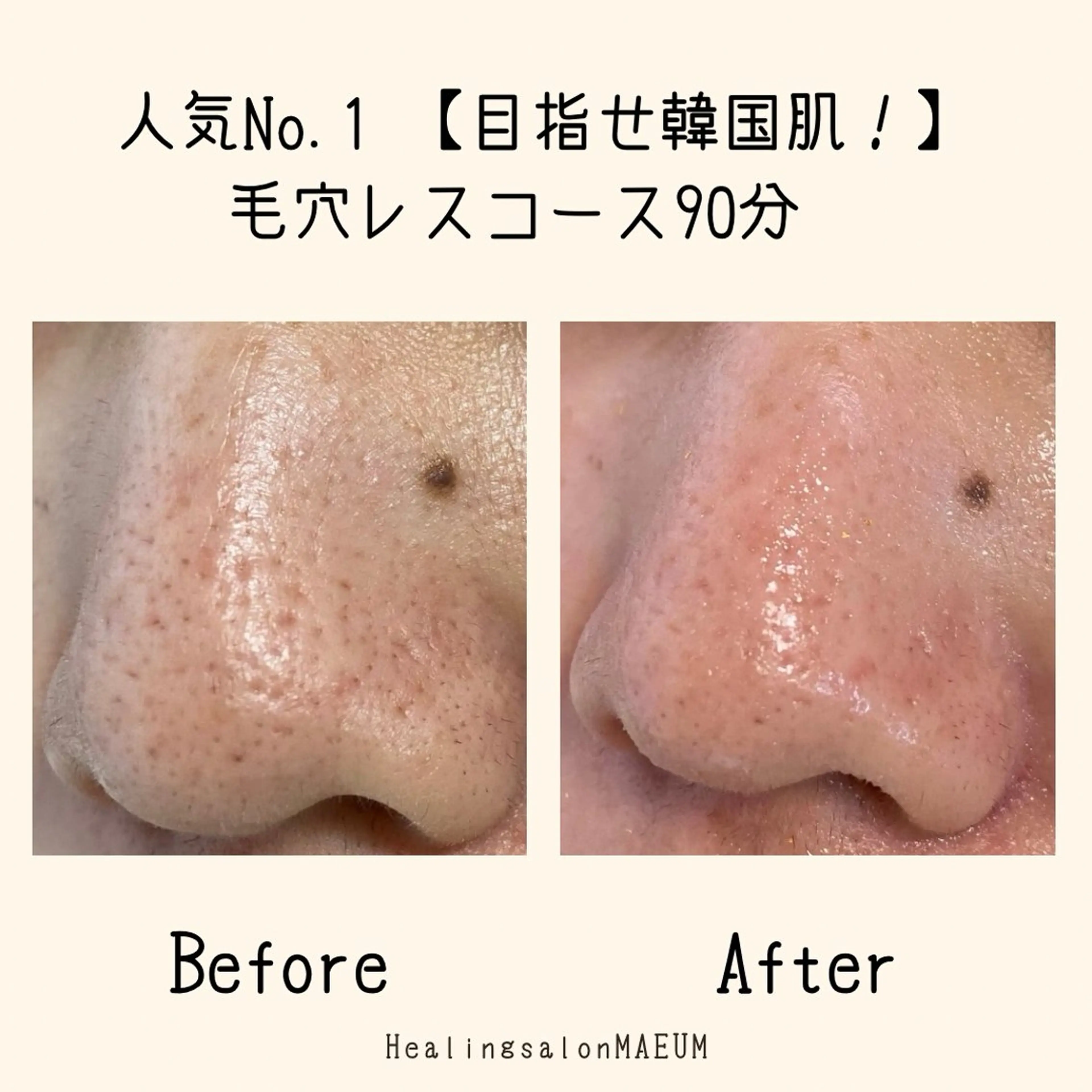 エステ MAEUM／ Sachiのネイルデザイン