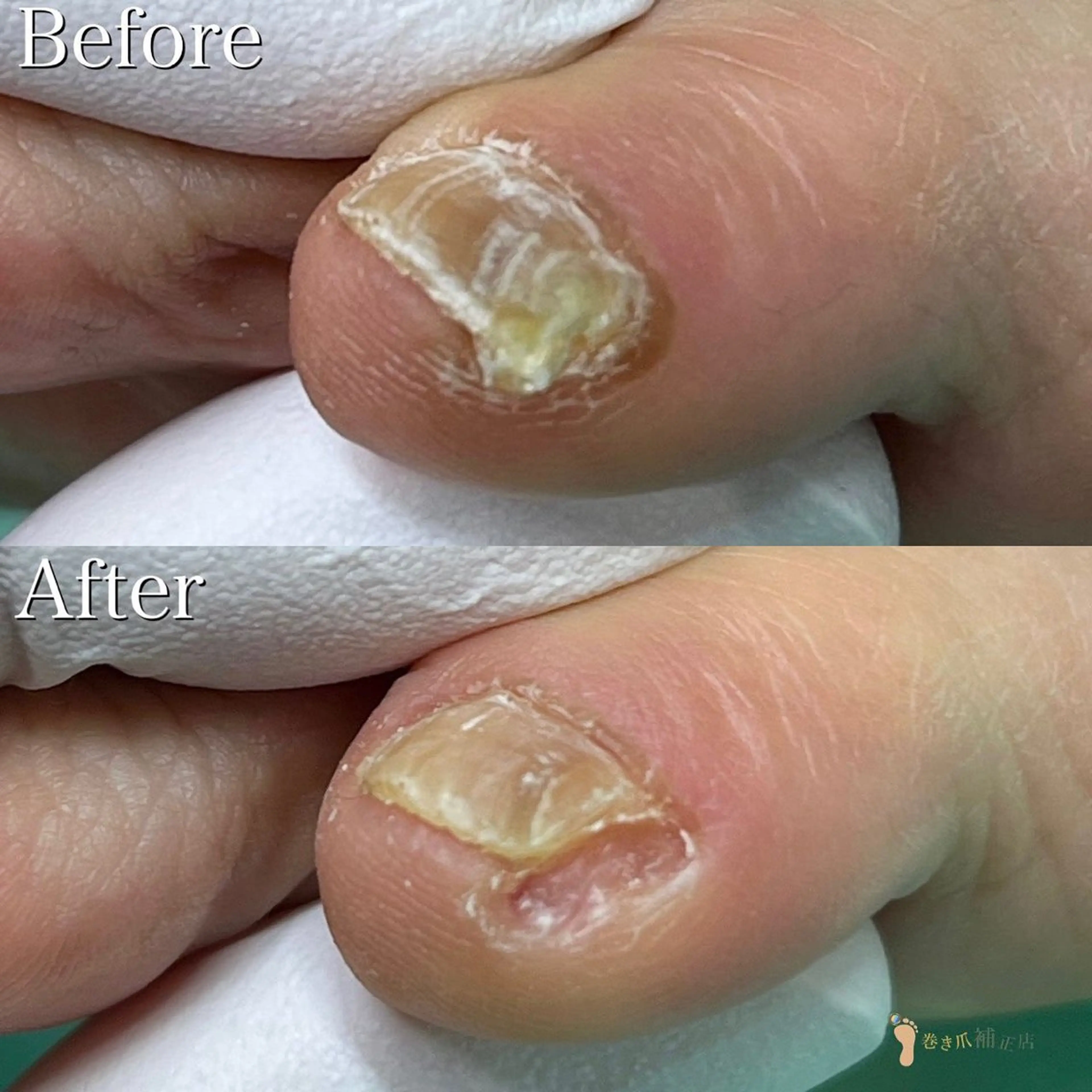 大宮 巻き爪補正店のエステ・リラクイメージ