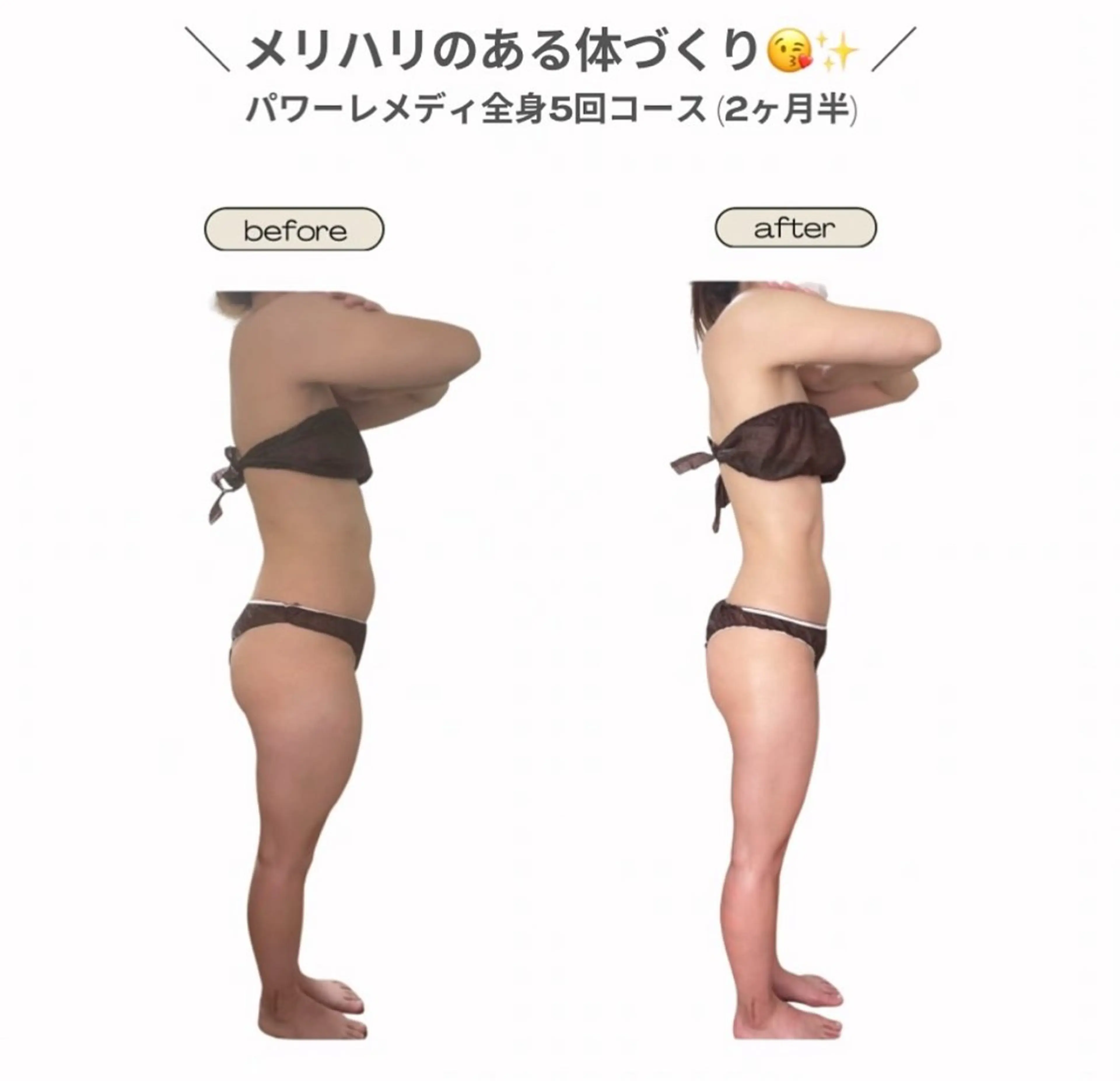エステ リラク 《本気痩せ×疲労改善 》  BILOOPのエステ・リラクイメージ