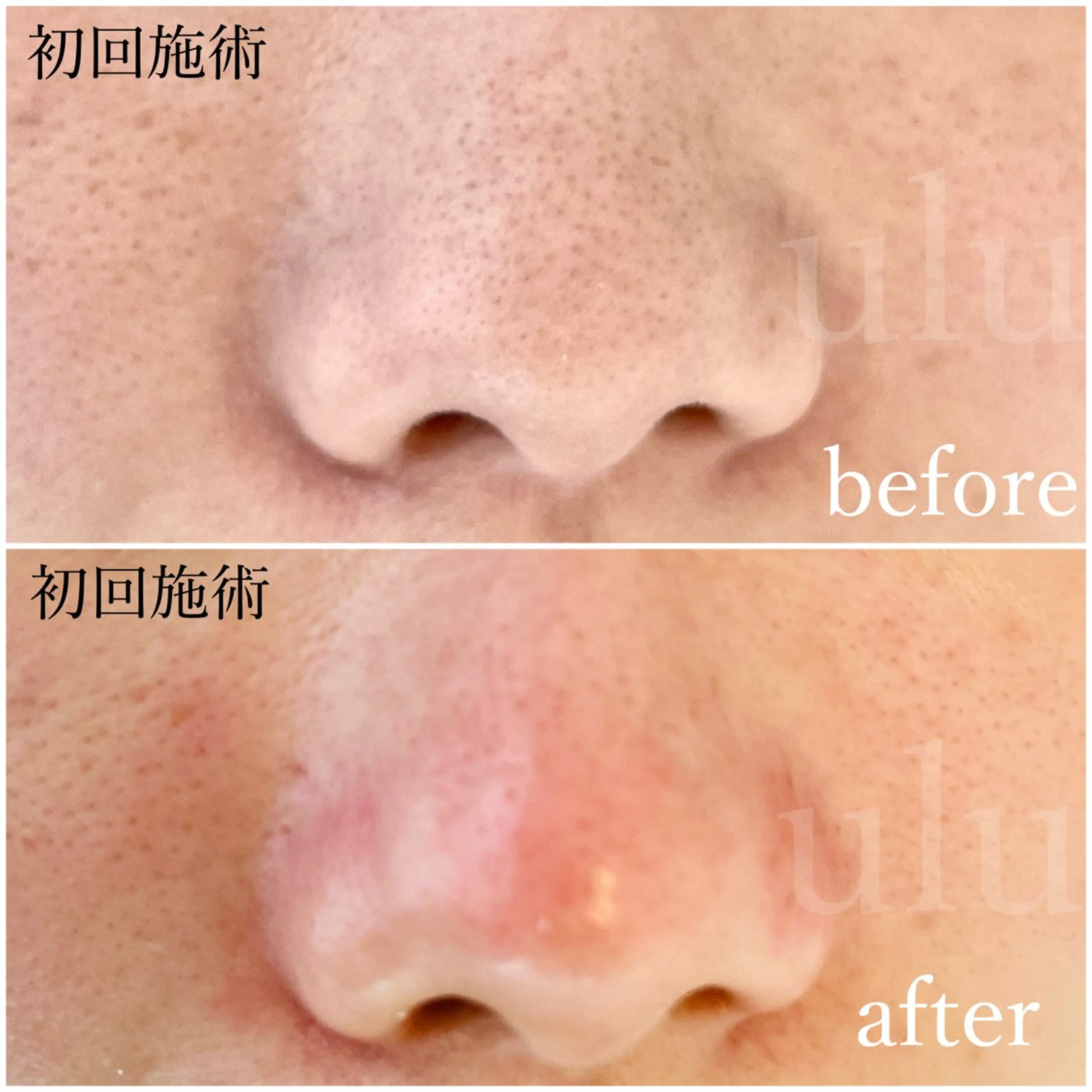 beauty salon uluの眉毛・アイブロウイメージ