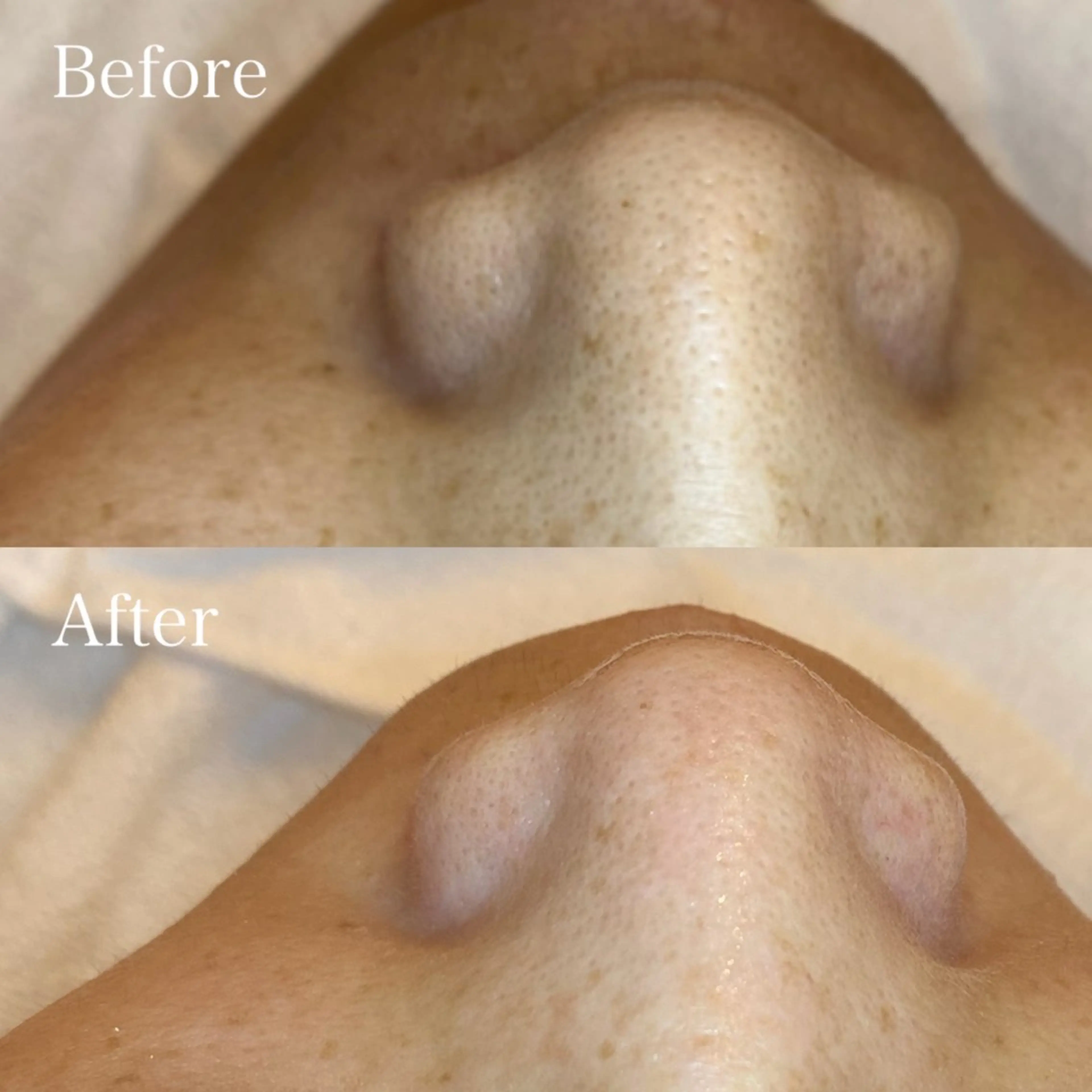 🤍アベシュリ /フェイシャル🤍のエステ・リラクイメージ