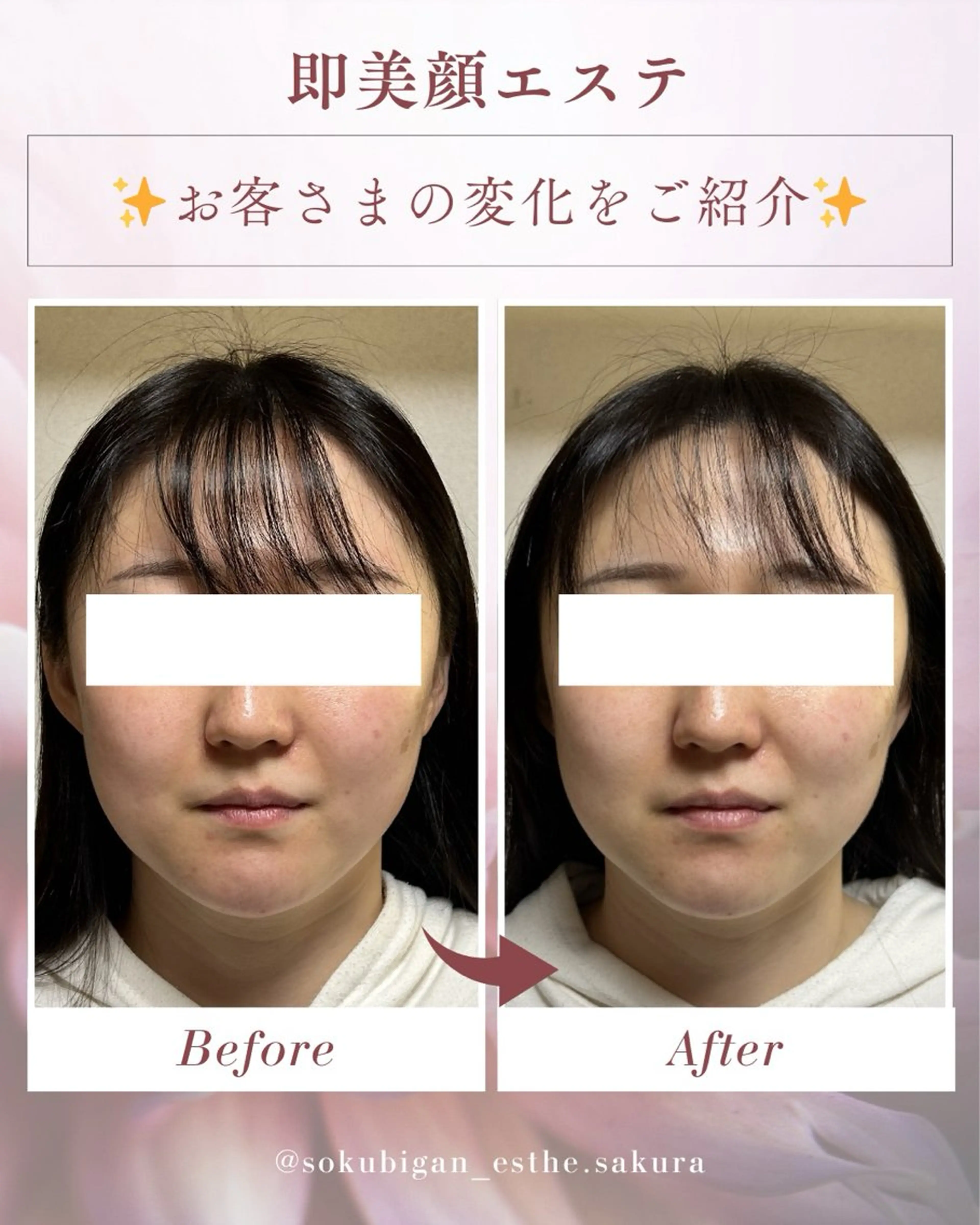 エステ リラク さくら｜むくみ顔専門 エステ｜銀座のエステ・リラクイメージ