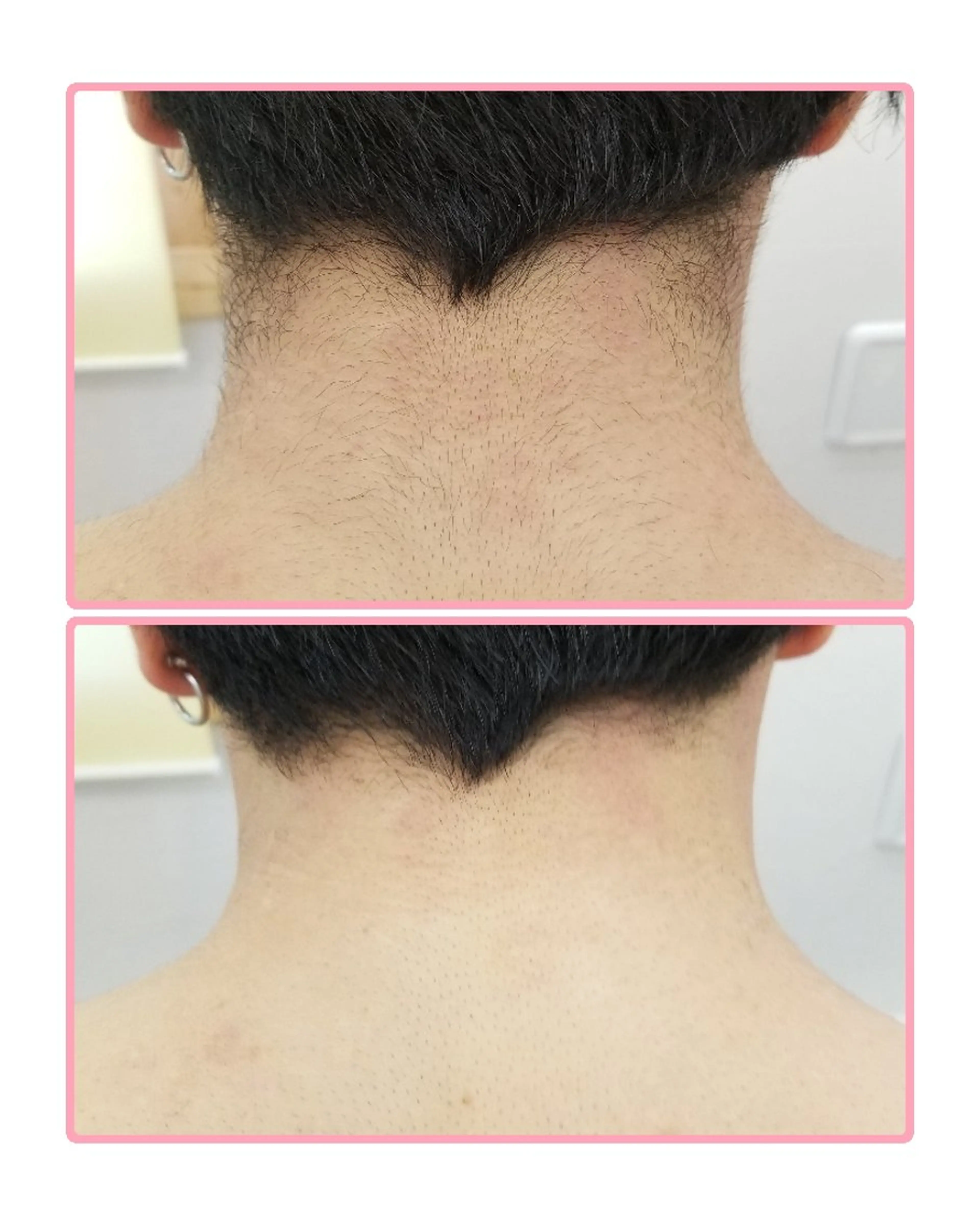 メンズ 脱毛 salonde ReGodのエステ・リラクイメージ