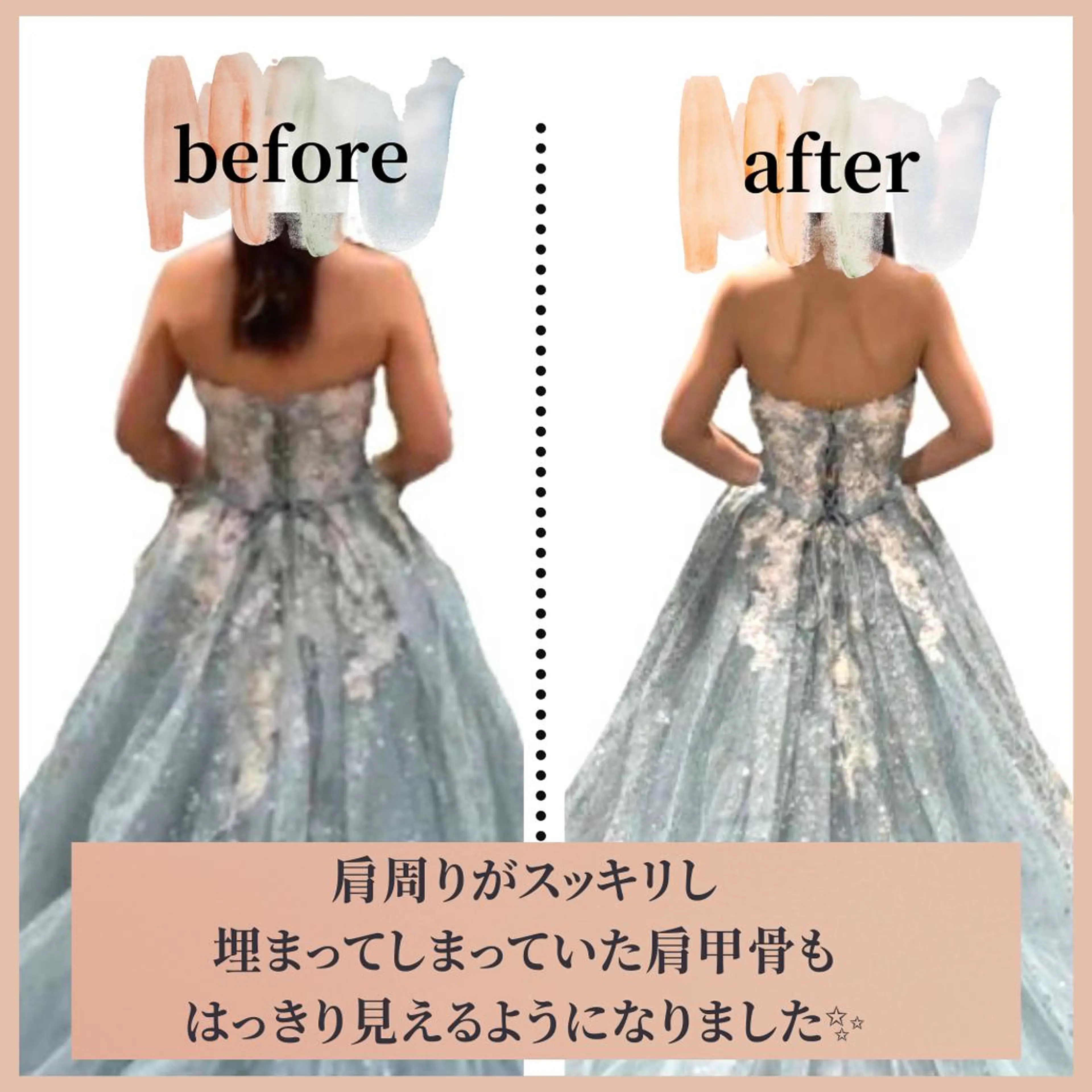 <Aお試し&相談>[10kg減量まで¥66,000～]目標体重まで通い放題コース&3年補償★180分！の写真