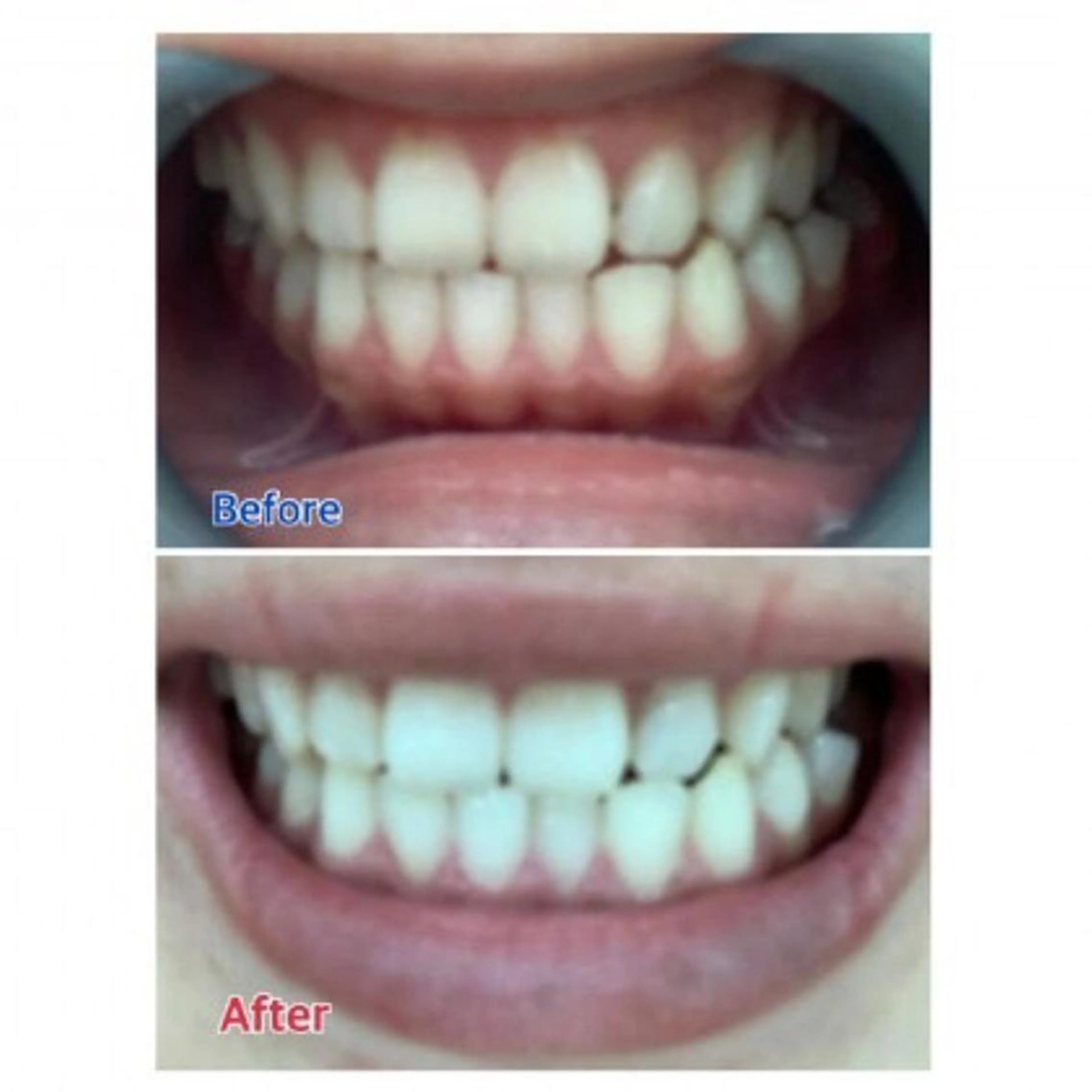 Ｍ渋谷 ホワイトニングのエステ・リラクイメージ