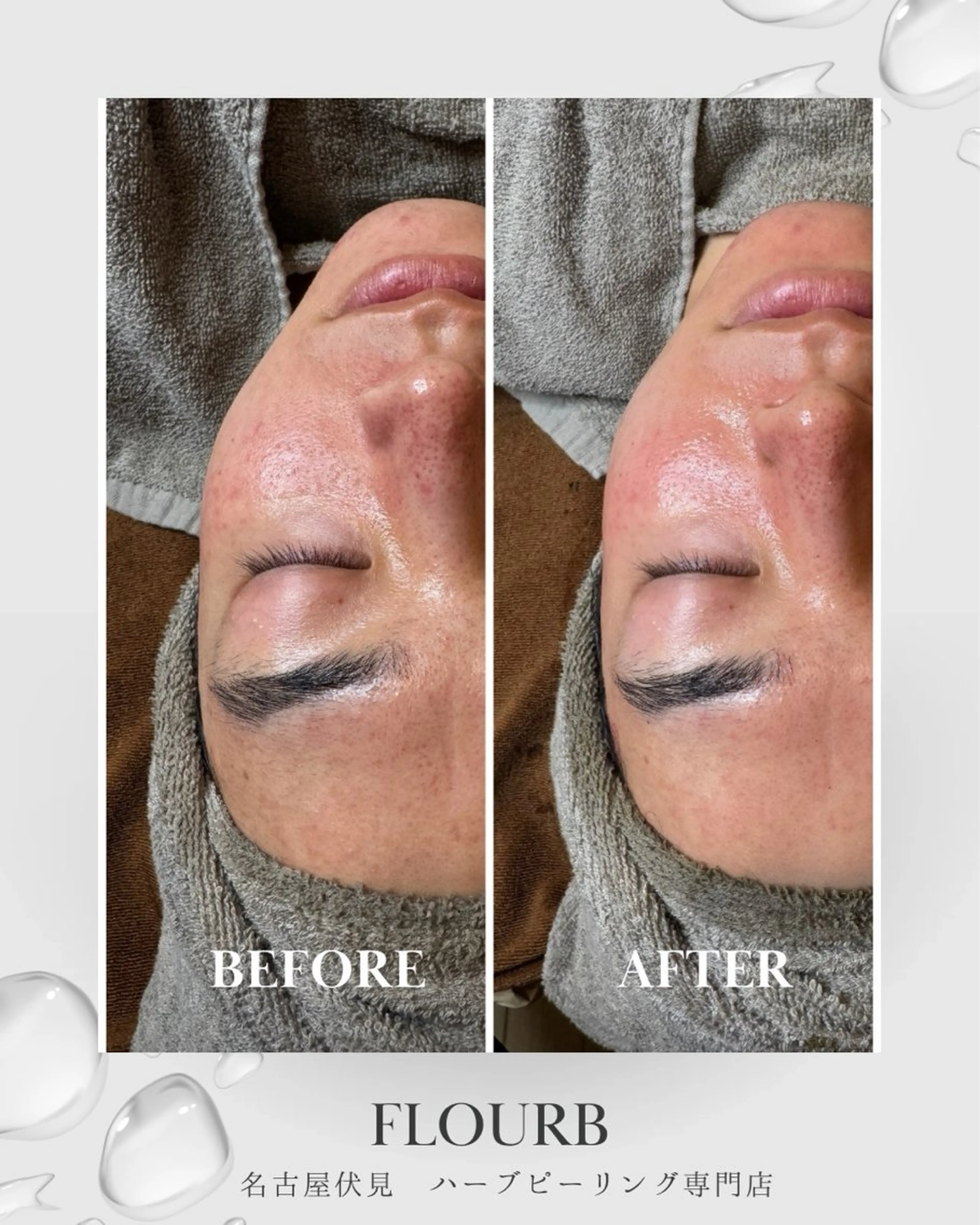 エステ ハーブピーリング専門 サロンFlourbのエステ・リラクイメージ