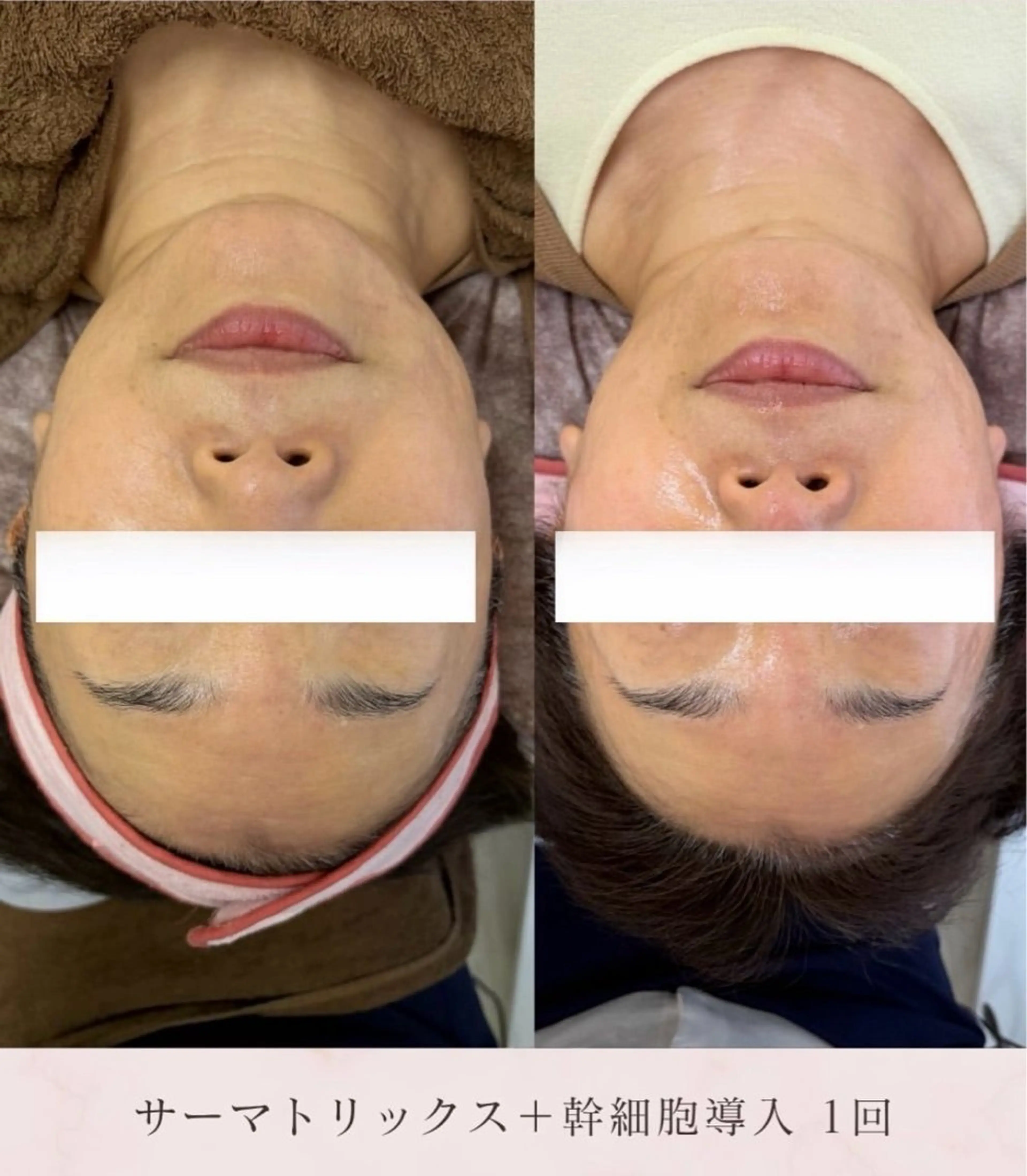 エステ 看護師が施術する美容 ナスサロshokoのエステ・リラクイメージ