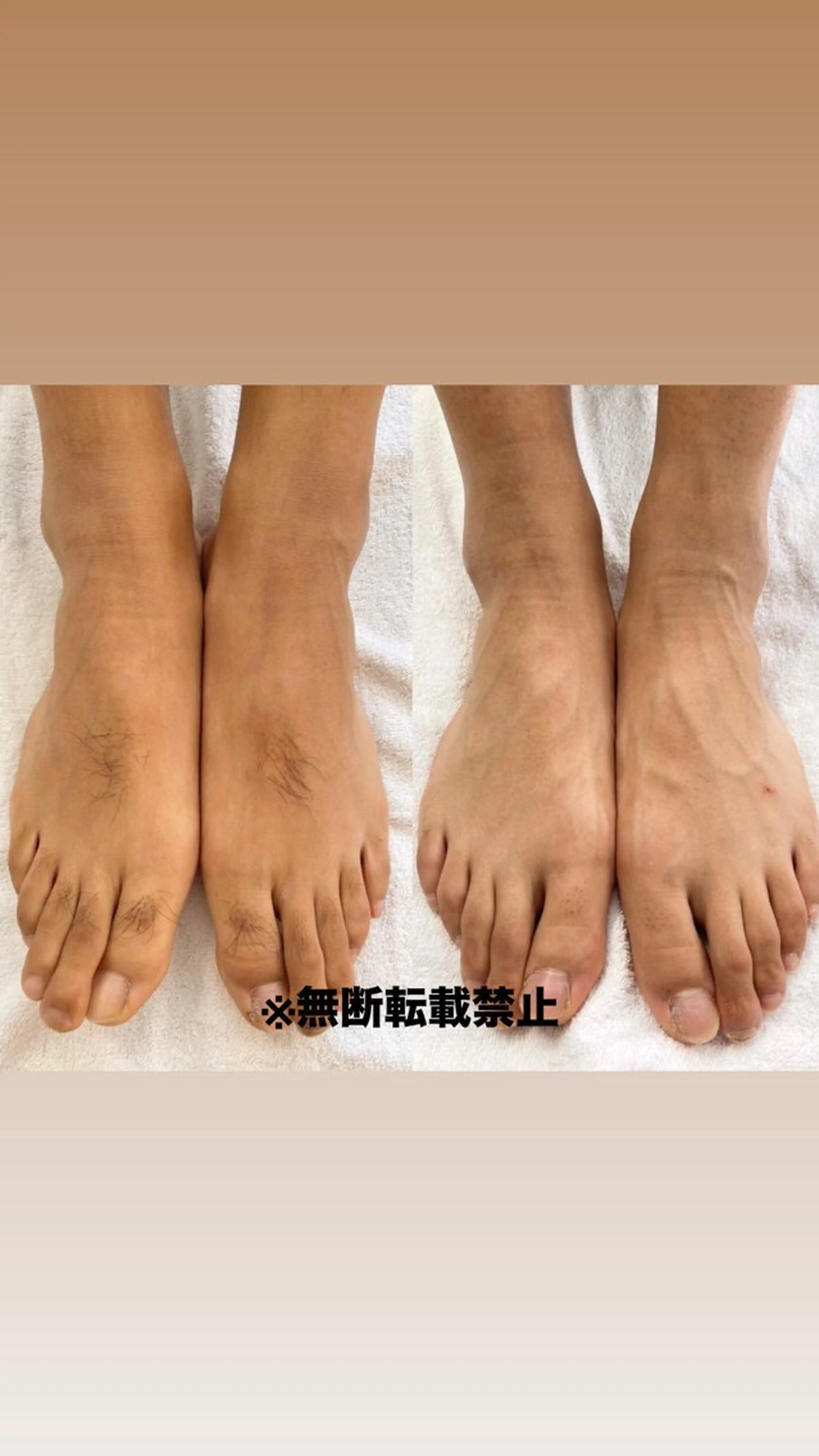 メンズ キッズ 親子脱毛サロン ReOluのエステ・リラクイメージ