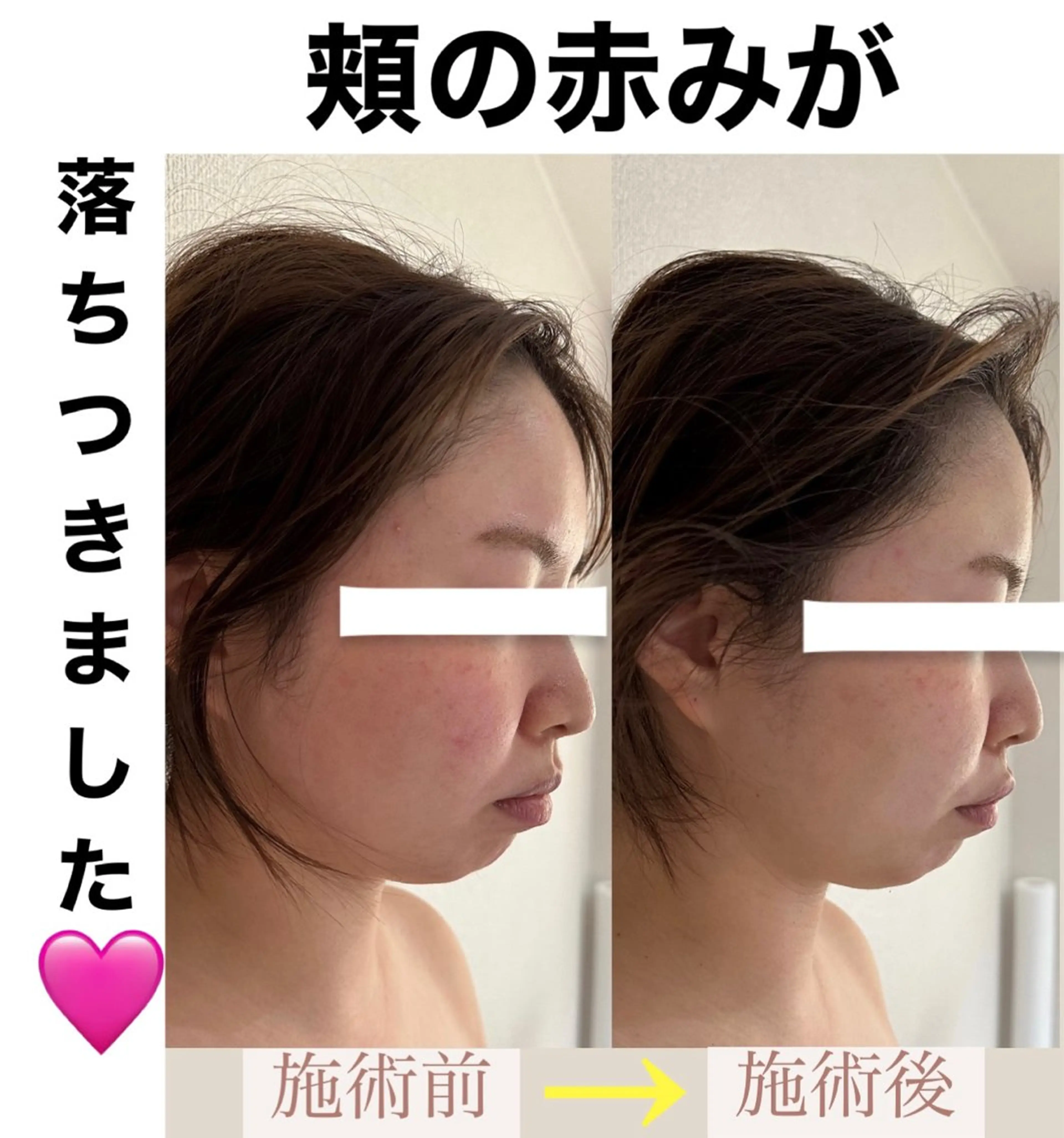 脱毛&美容サロン BLUESEAのエステ・リラクイメージ