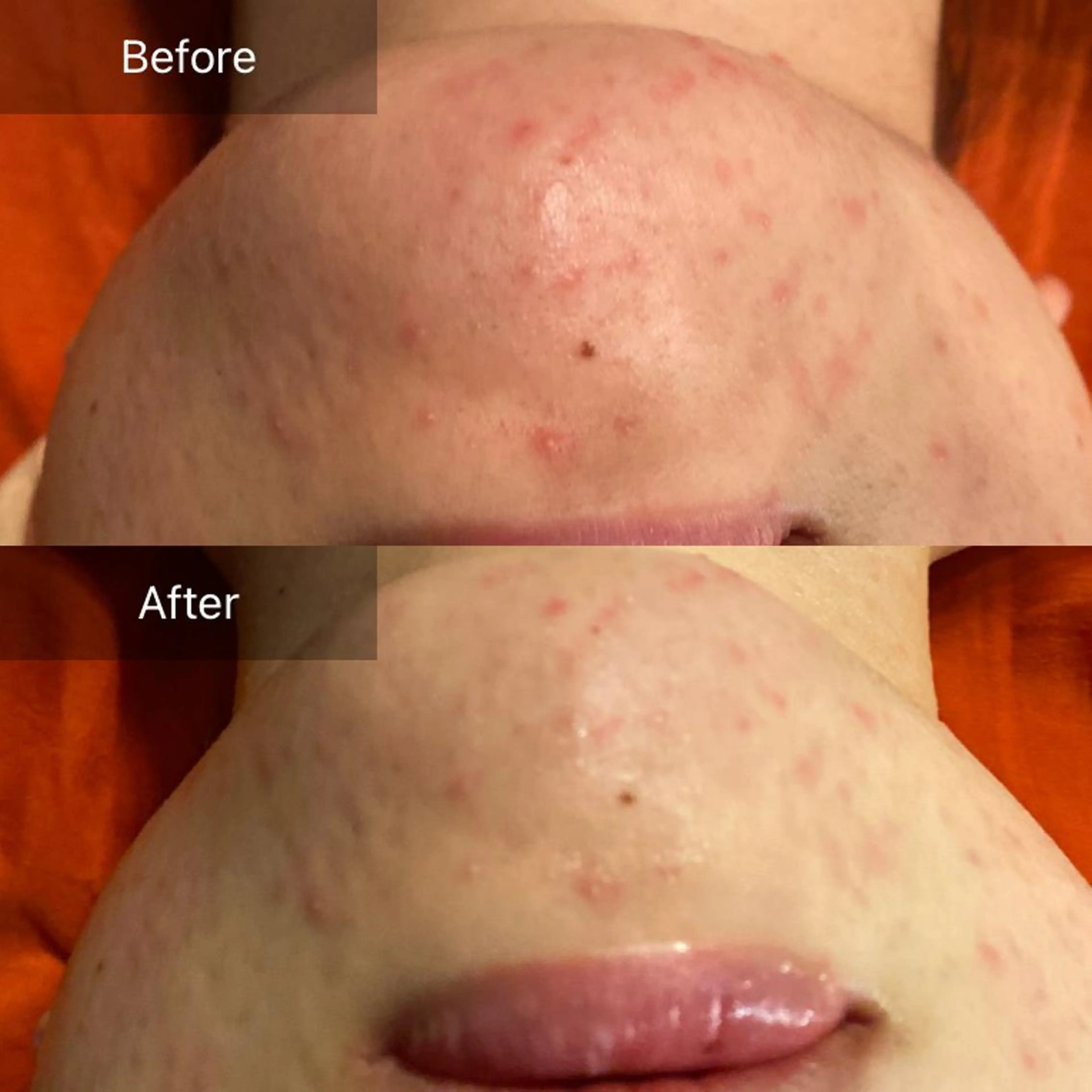 毛穴から始める肌メン テマンダリンオレンジのエステ・リラクイメージ