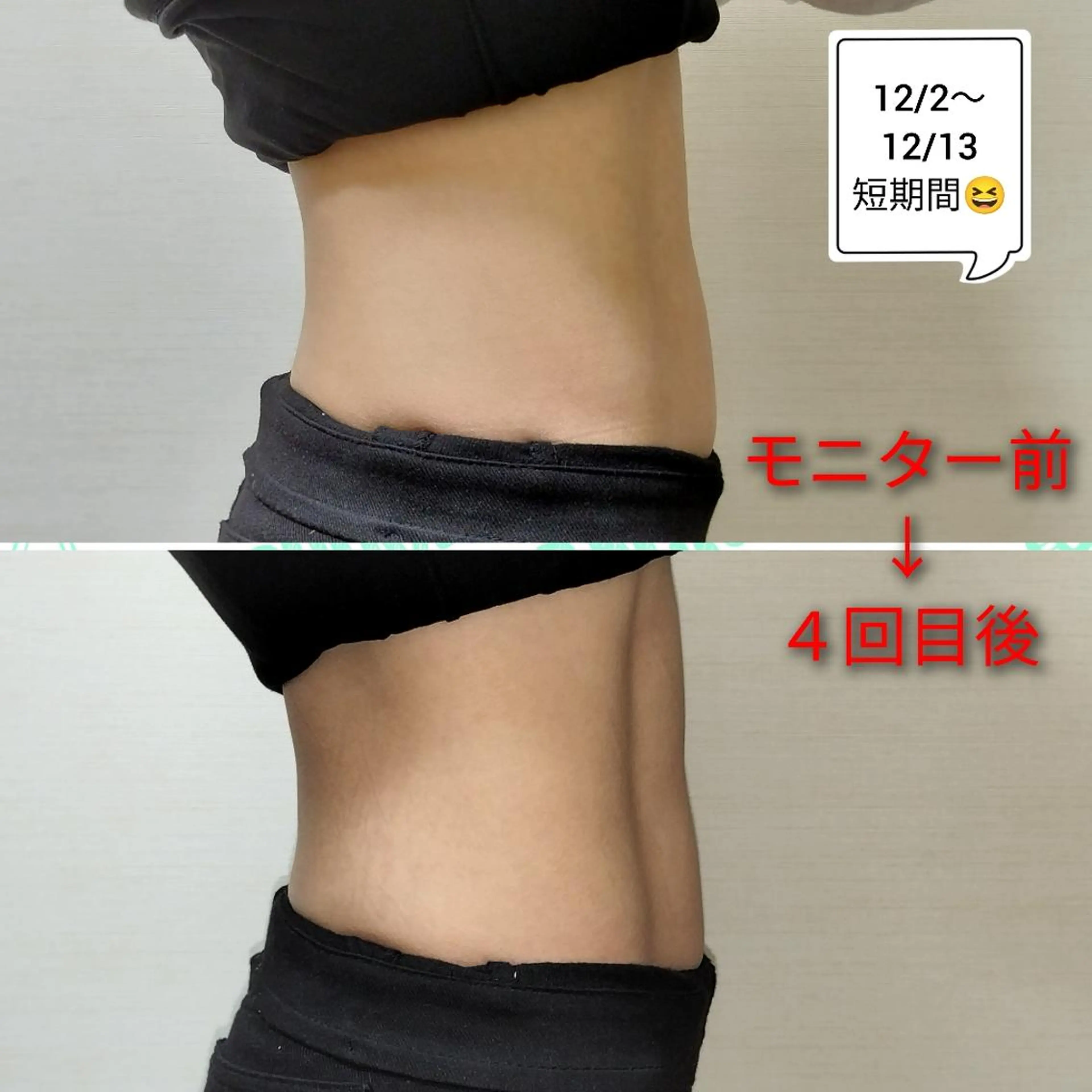 女性OK!結婚式の主役も式に呼ばれてる方にもオススメ🌟テスラ･シェイプ30分🌈🌈（4万回）腹筋！の写真