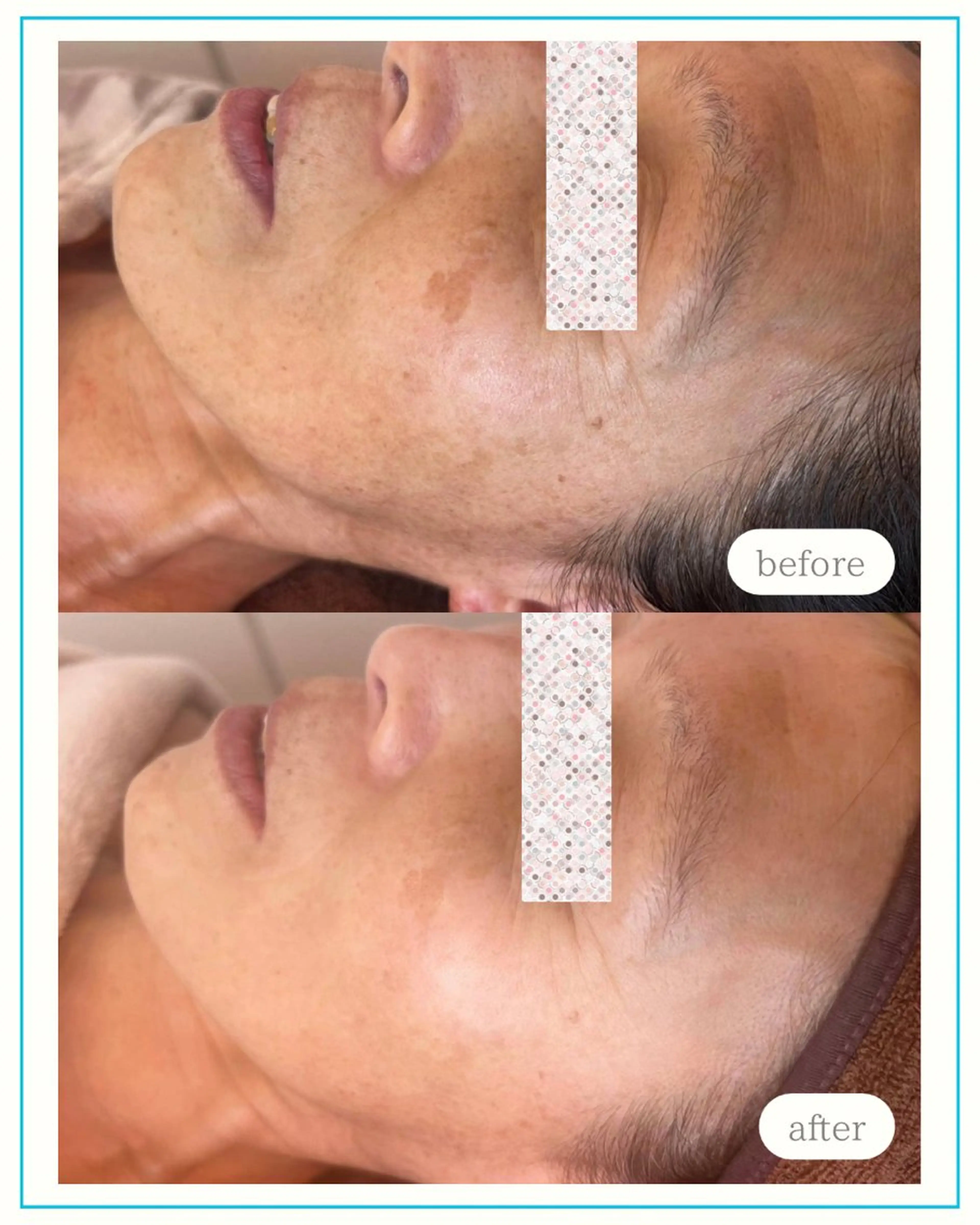 エステ 🌞シミケアサロン @SUNiko🌴のエステ・リラクイメージ