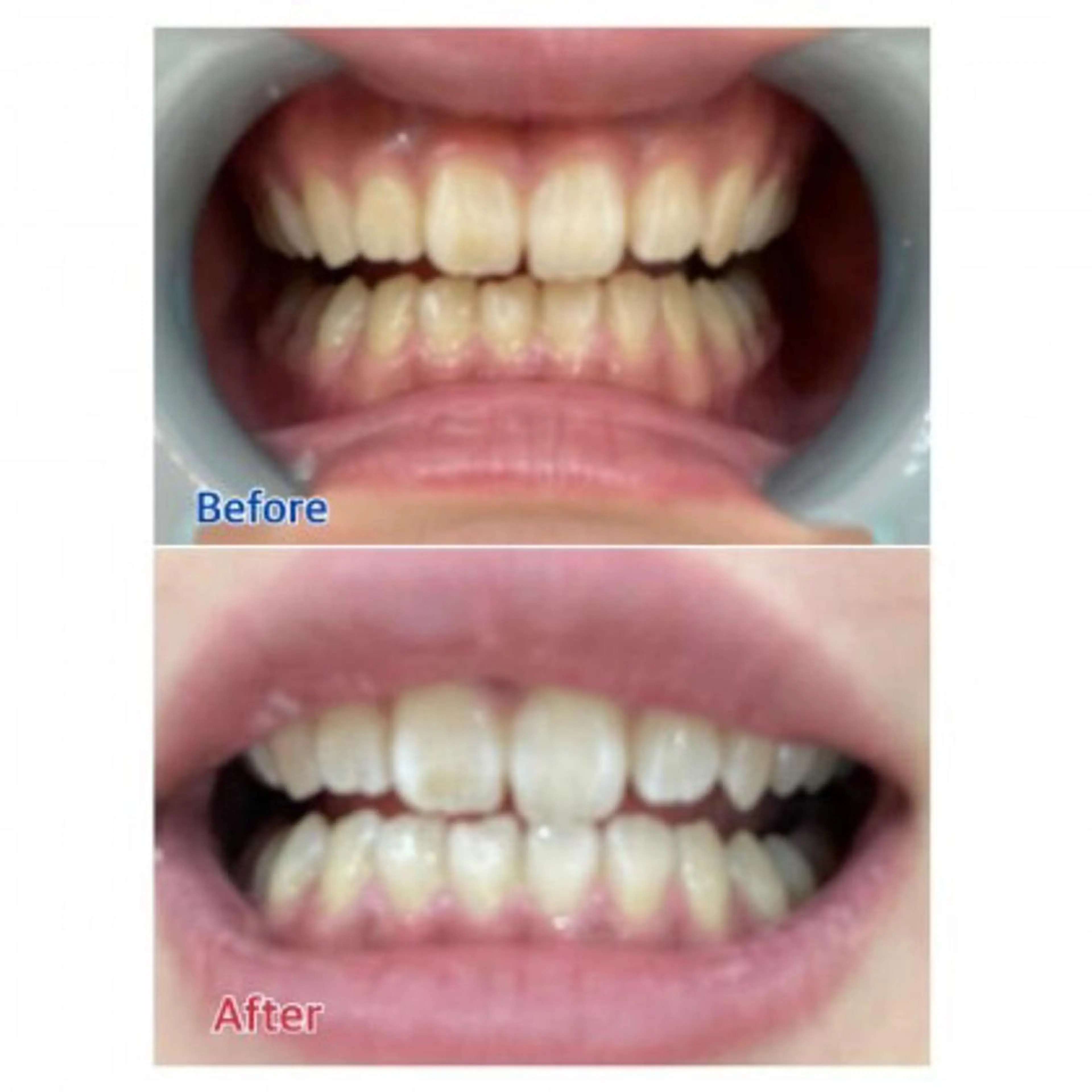 Ｍ渋谷 ホワイトニングのエステ・リラクイメージ