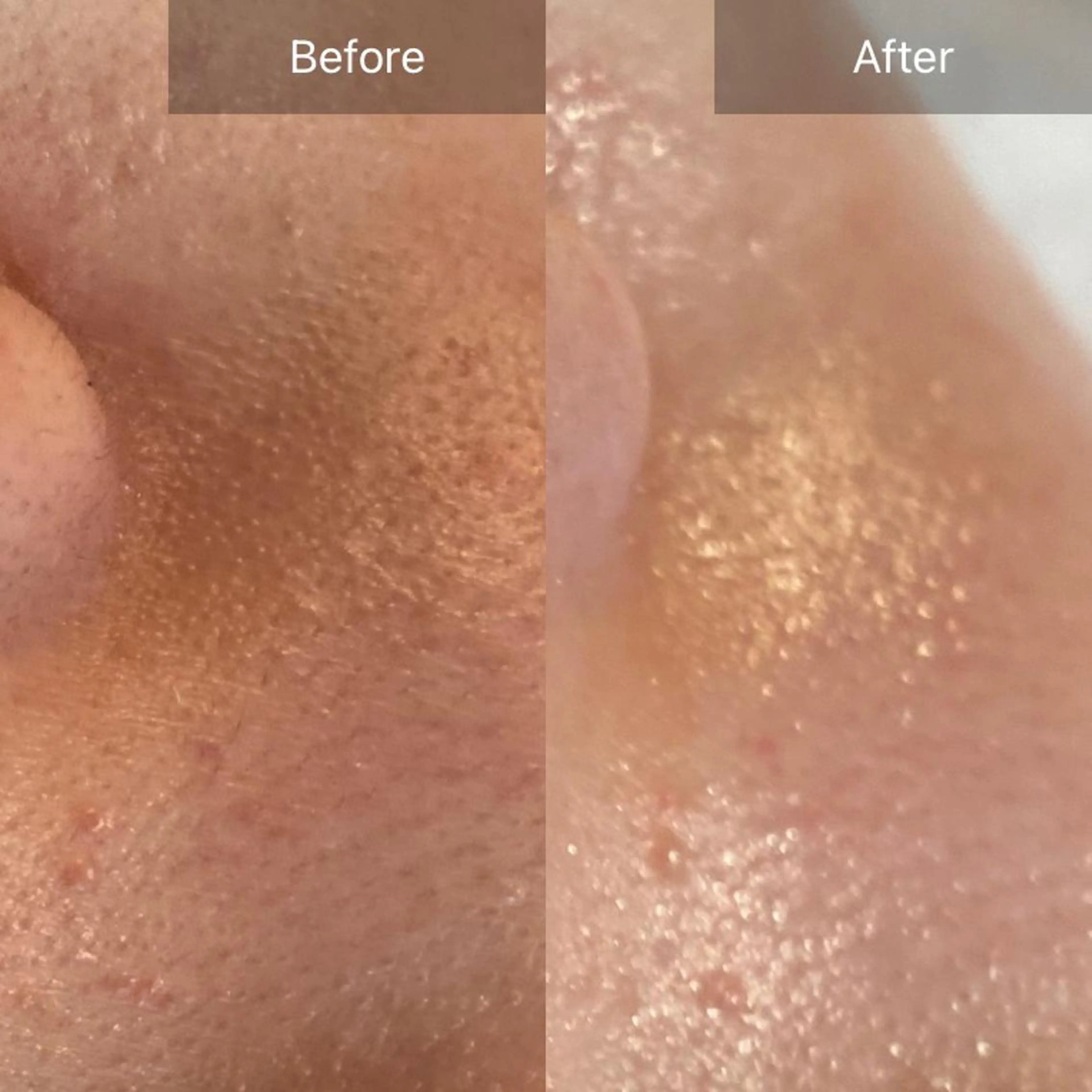 Mandarin Orange所属・毛穴から始める肌メン テマンダリンオレンジのエステ・リラクイメージ