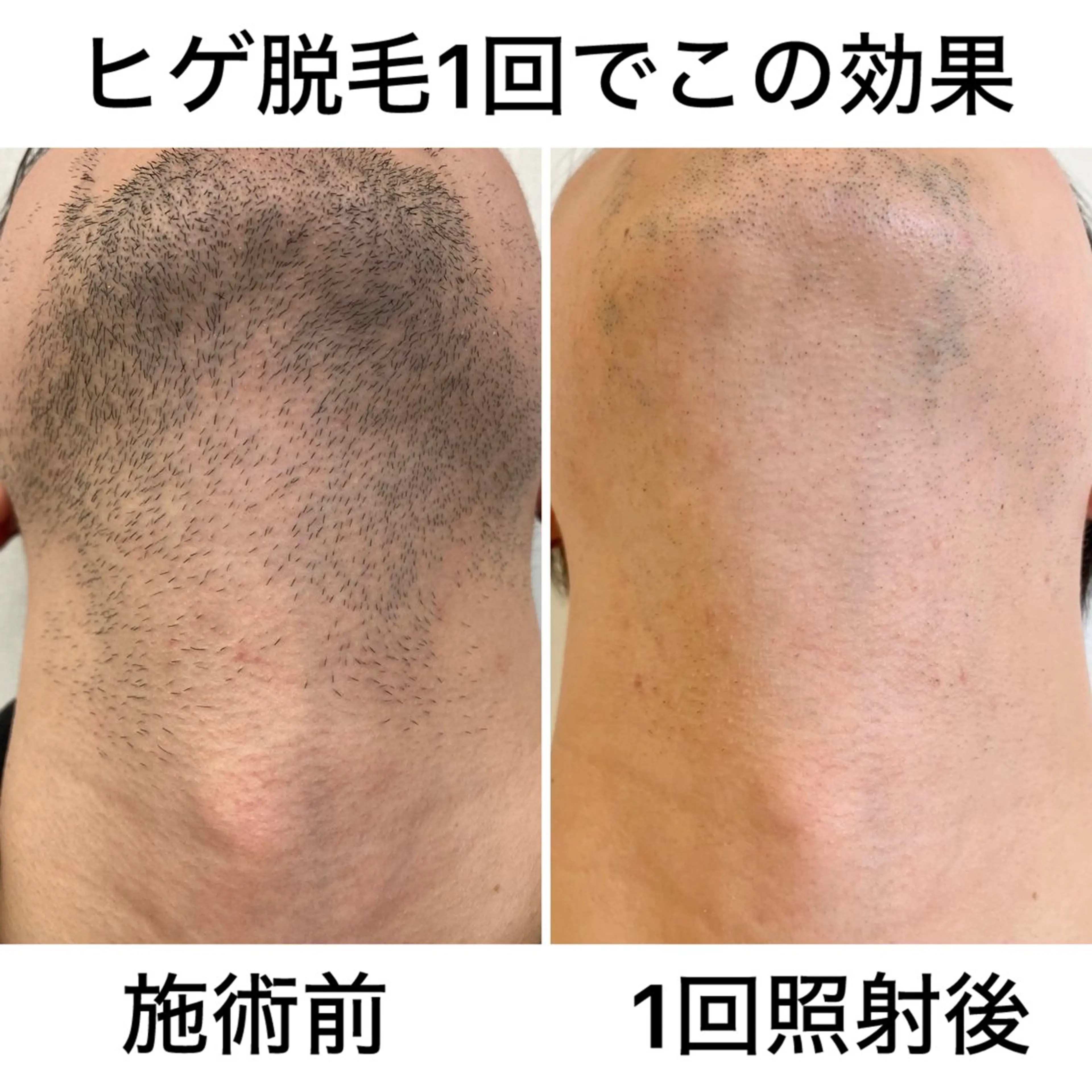 メンズ H.beau＋ 岩切 優華の眉毛・アイブロウイメージ