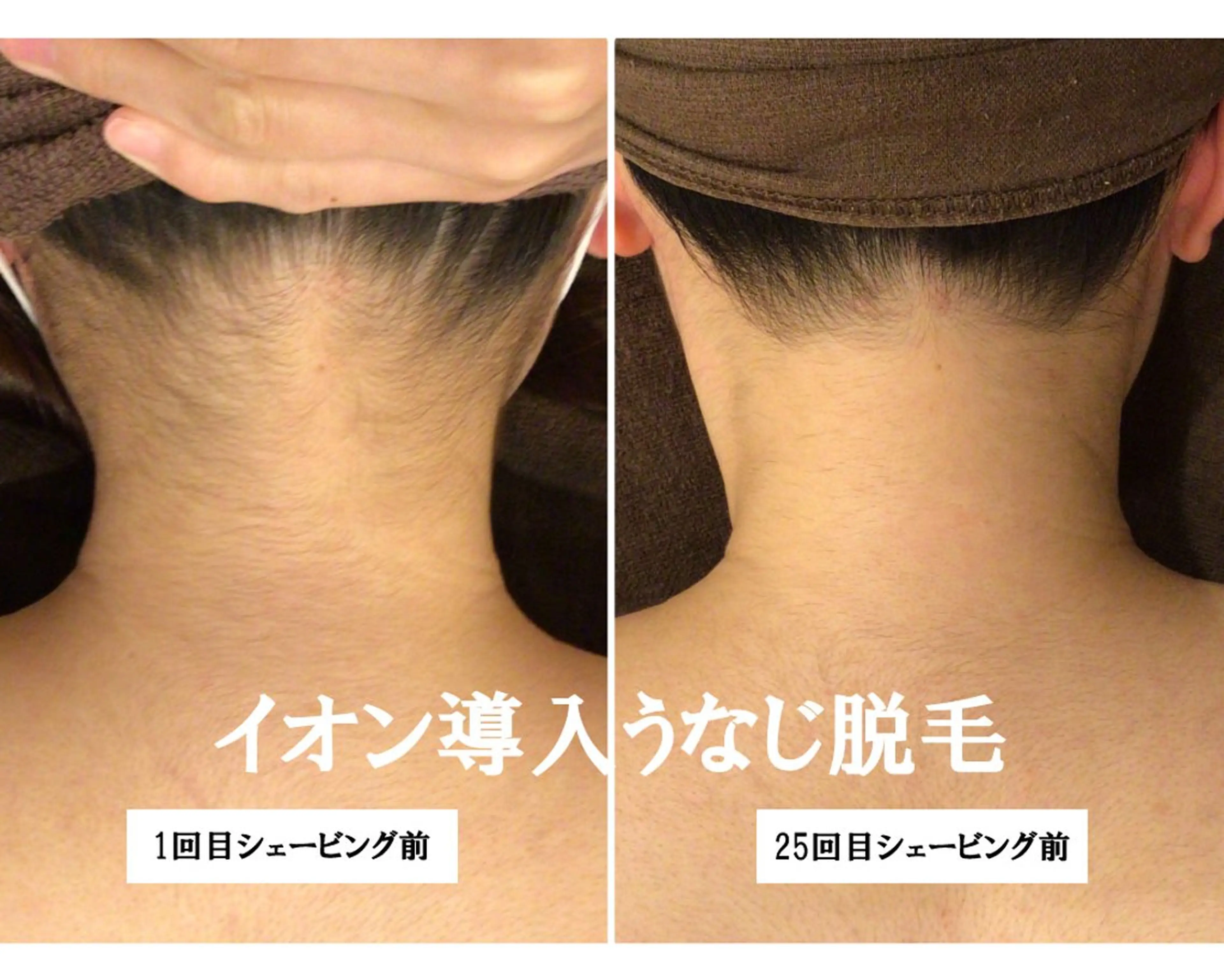 脱毛 Beauty  salon Lino所属・🎀うなじ脱毛🎀 ㅣLino堀江のエステ・リラクイメージ