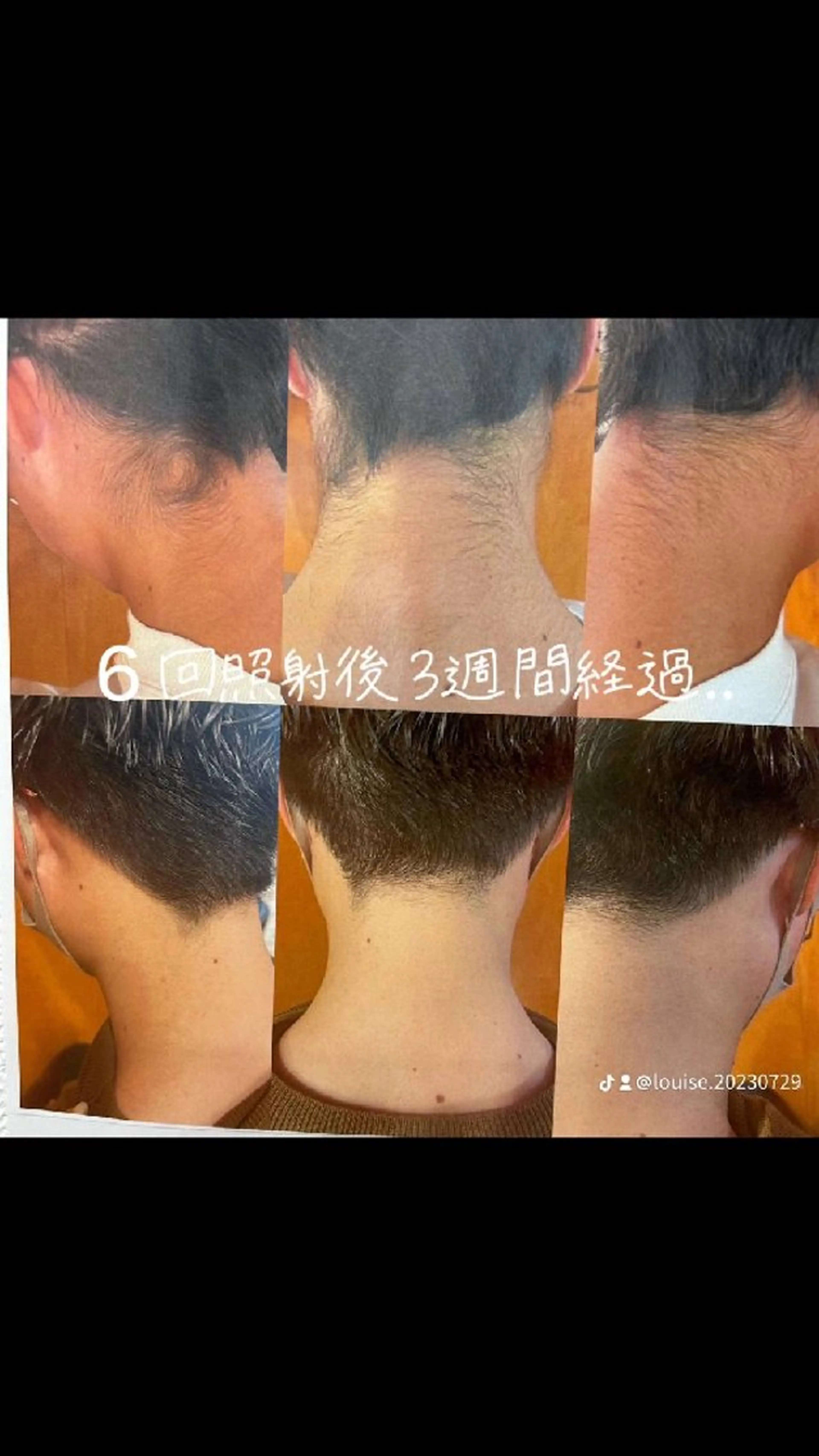 LOUISE. ／脱毛のエステ・リラクイメージ