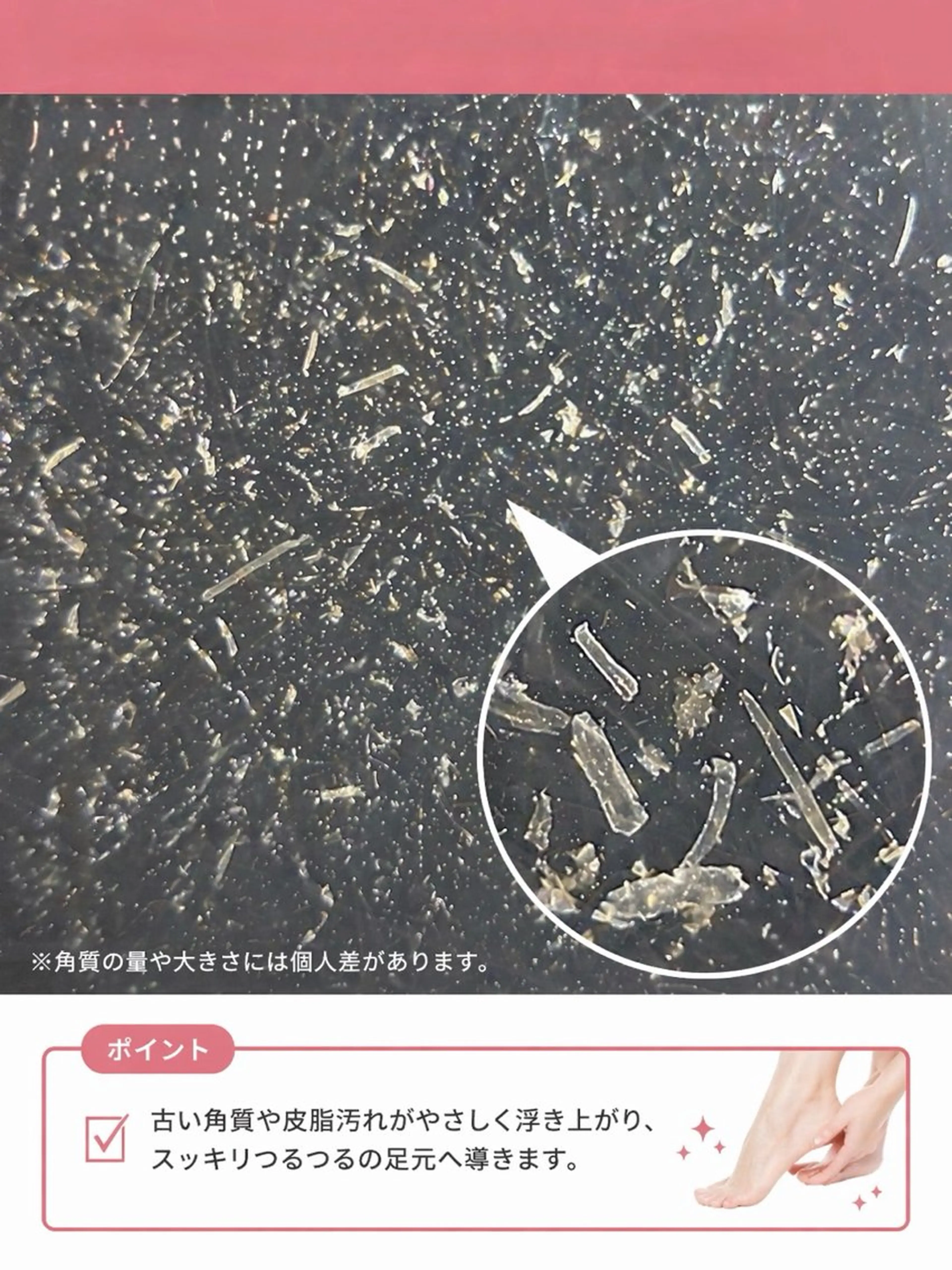 足の角質ケア(フットバス付)の写真