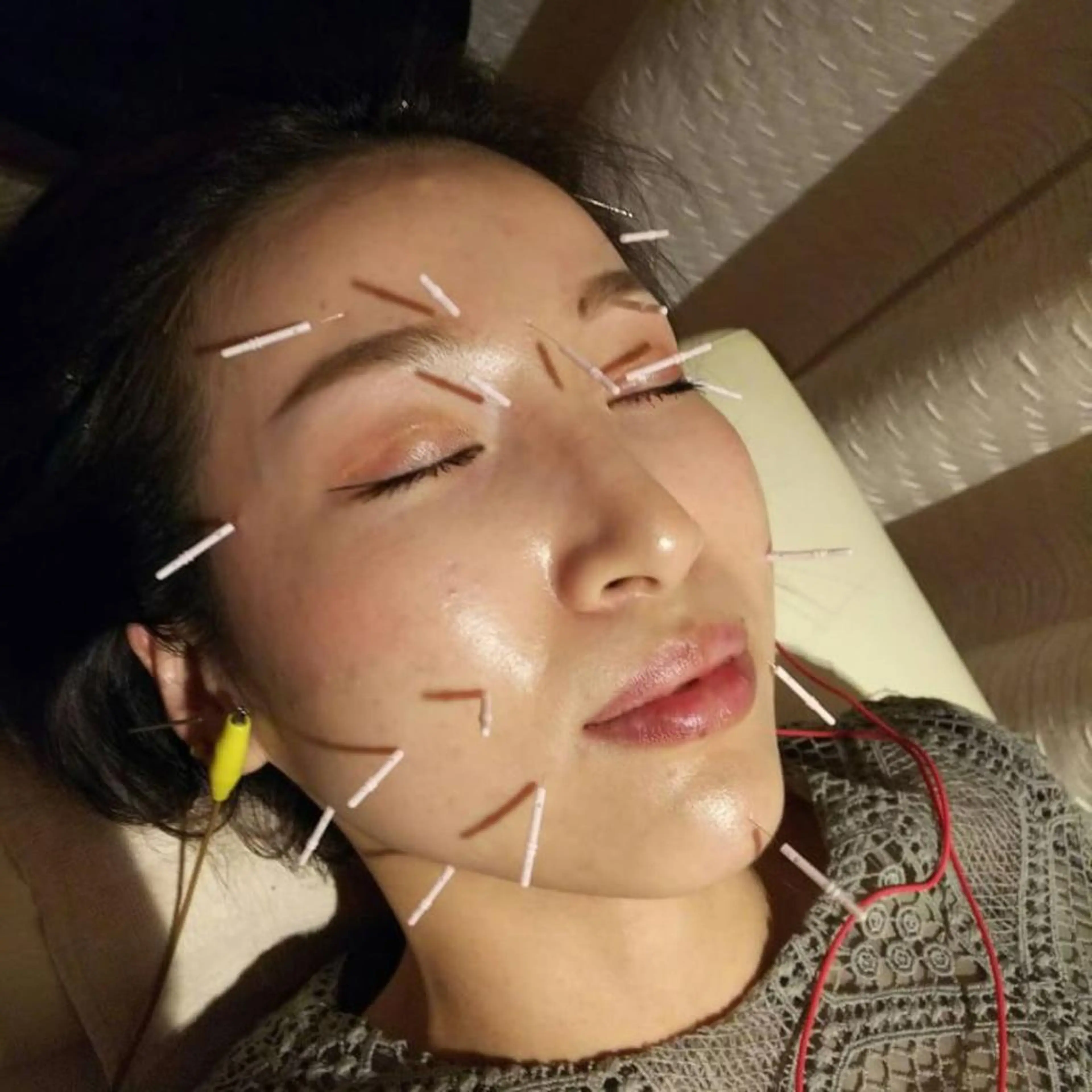 むくみたるみ専門☆ 美容鍼・小顔矯正のエステ・リラクイメージ