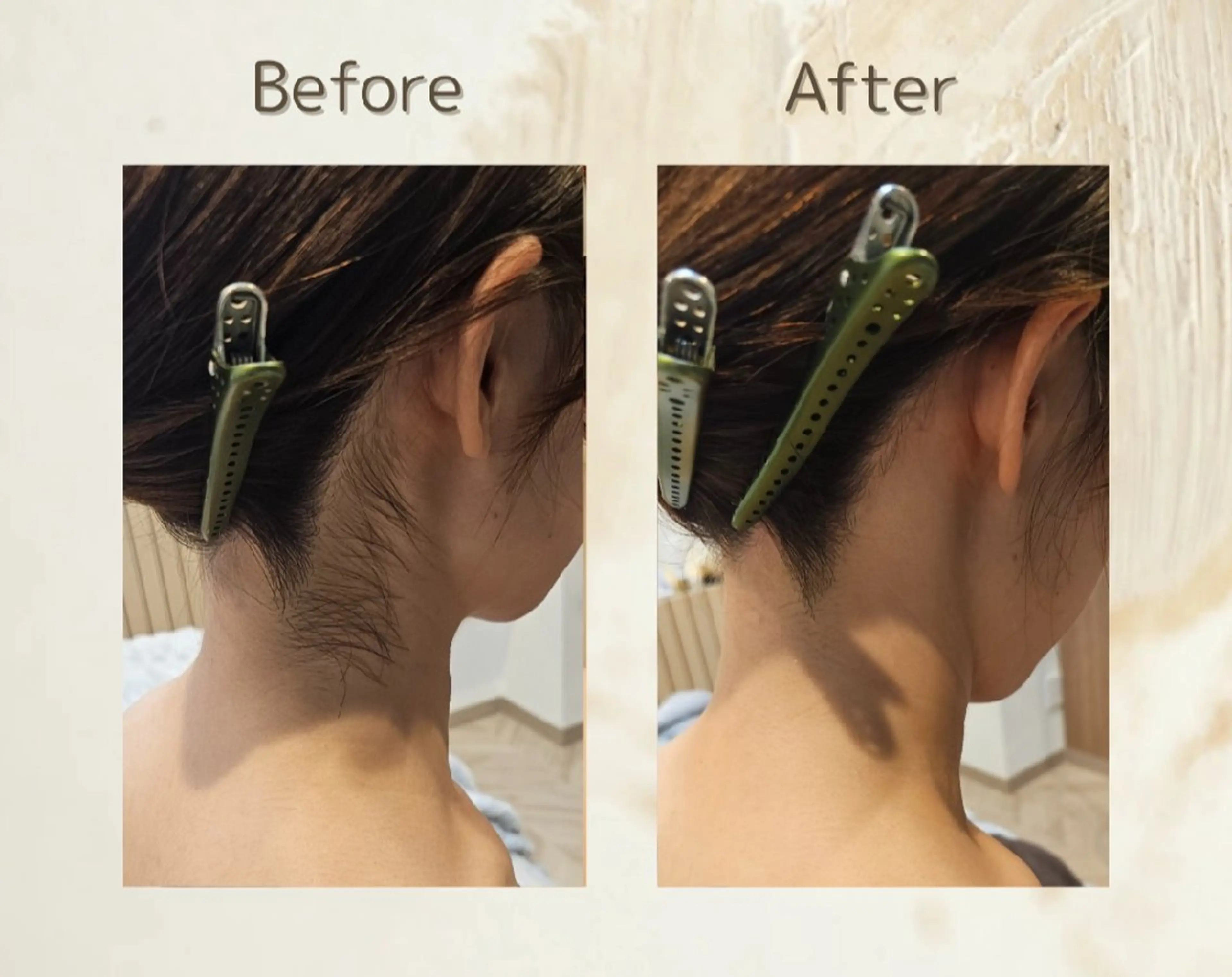 エステ シェービングサロン アンダブル/鴨井のその他イメージ