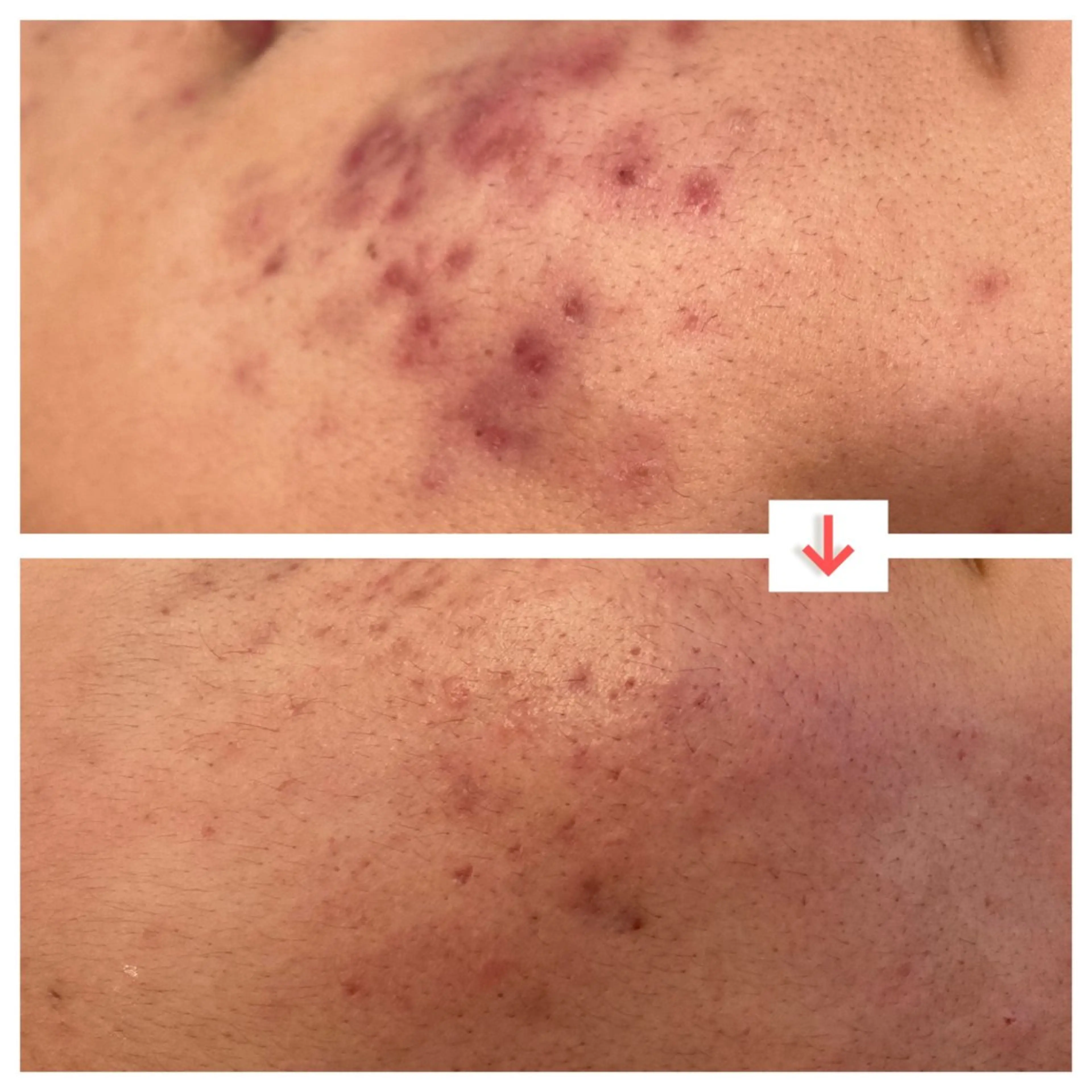 たるみ改善小顔エステ 堀葉月のその他イメージ