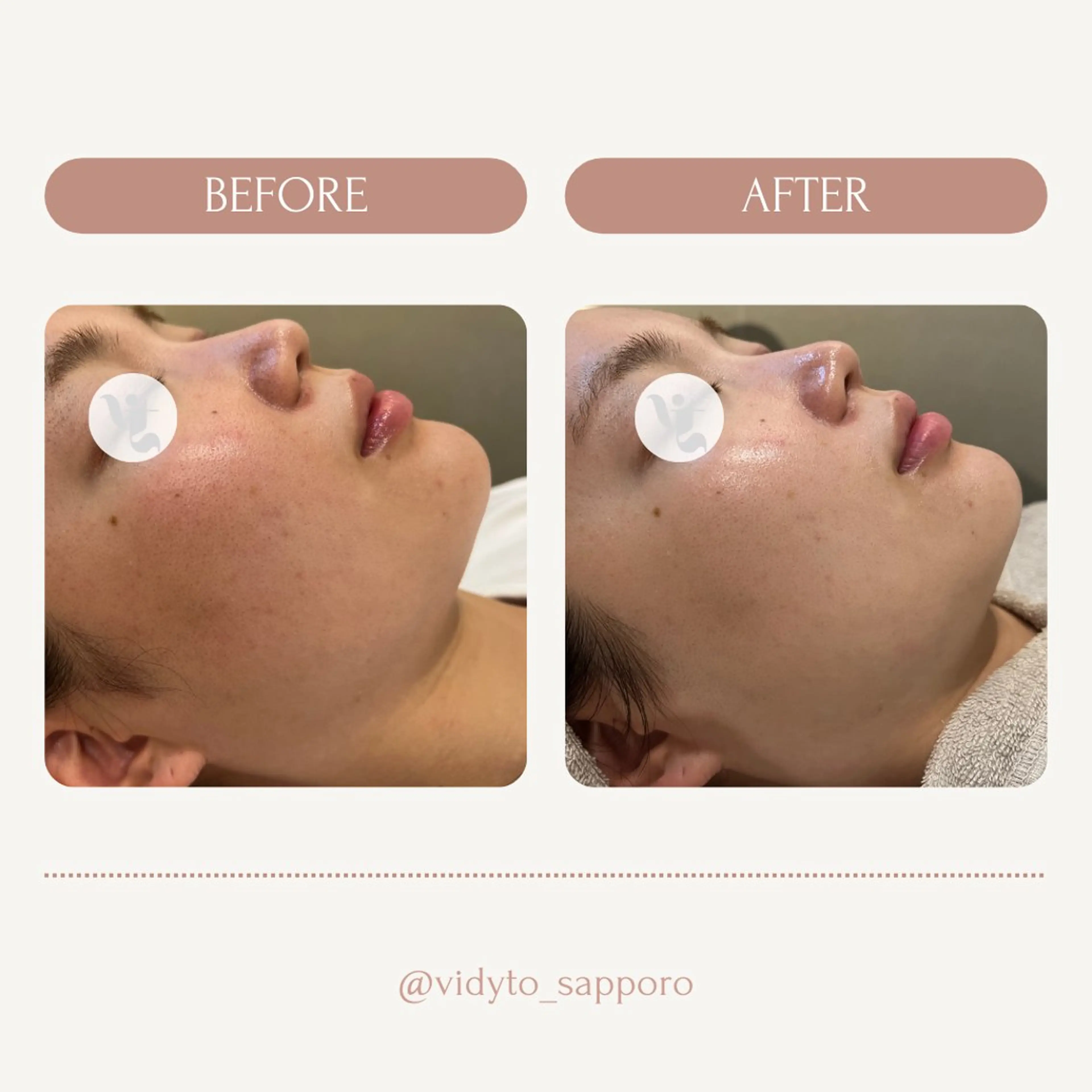 【vidyto】ヴィディトゥ所属・肌管理サロン vidyto MOEのエステ・リラクイメージ