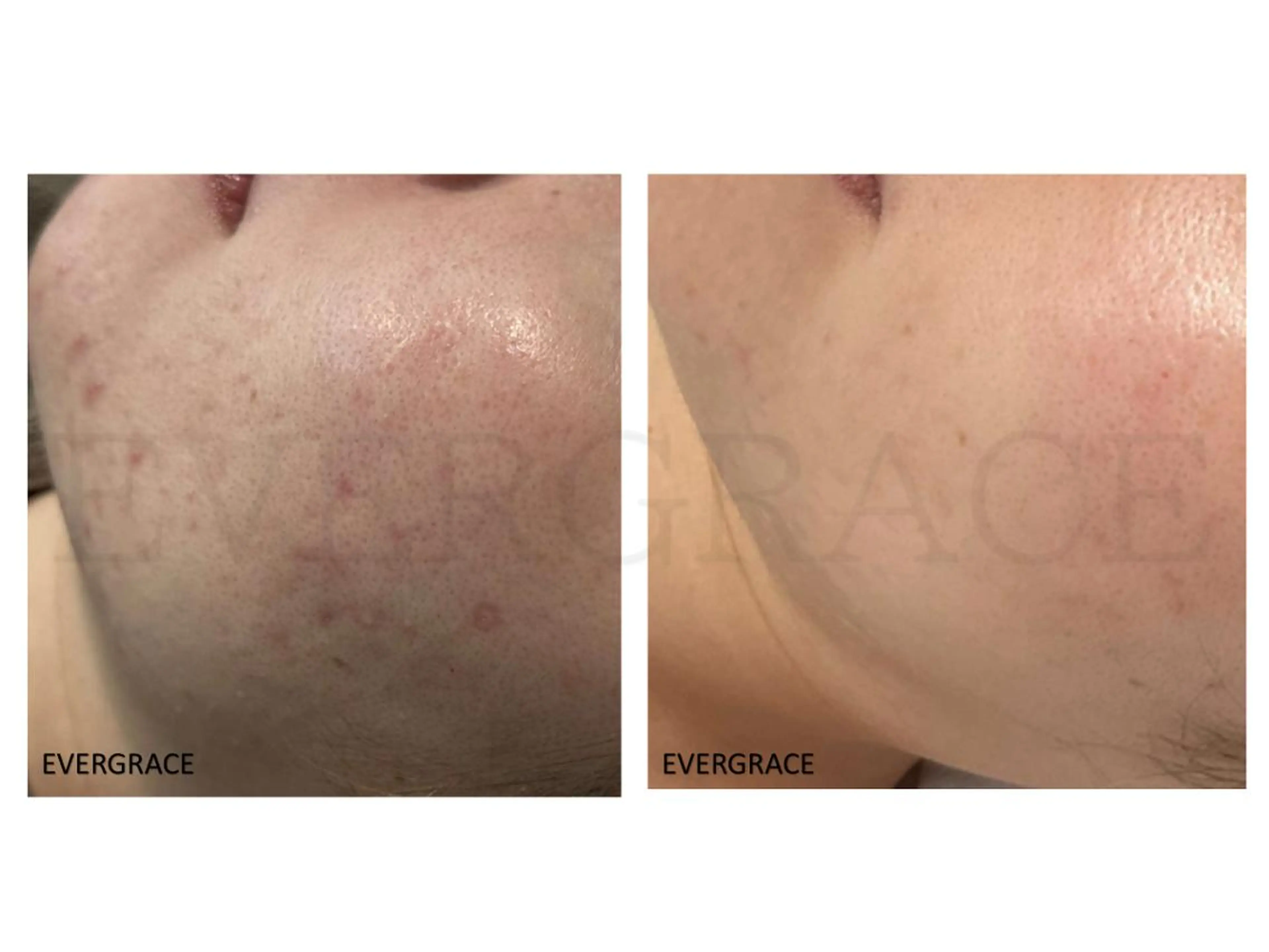 エヴァーグレース 金山店のエステ・リラクイメージ