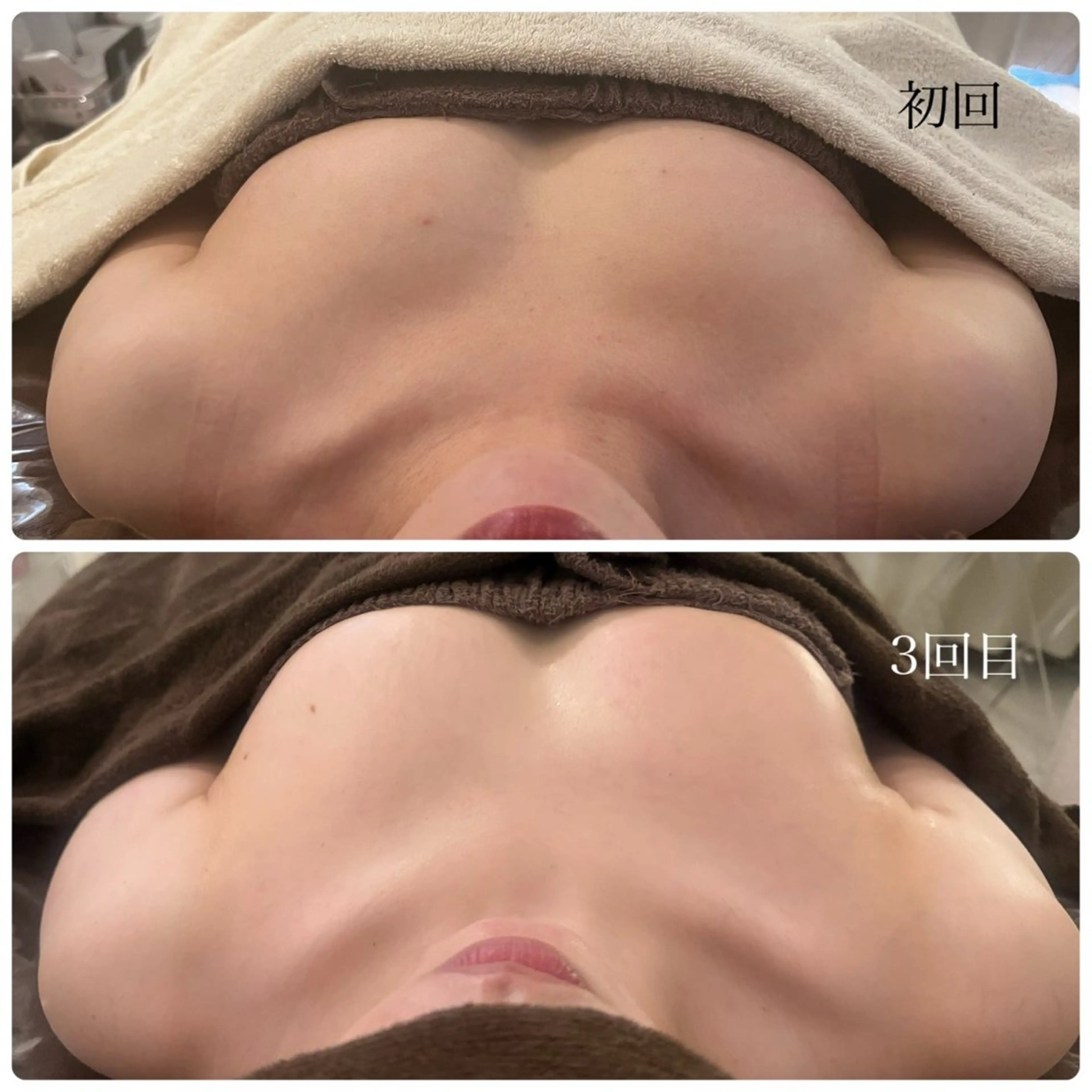 エステ Gemini 　MIKIのエステ・リラクイメージ