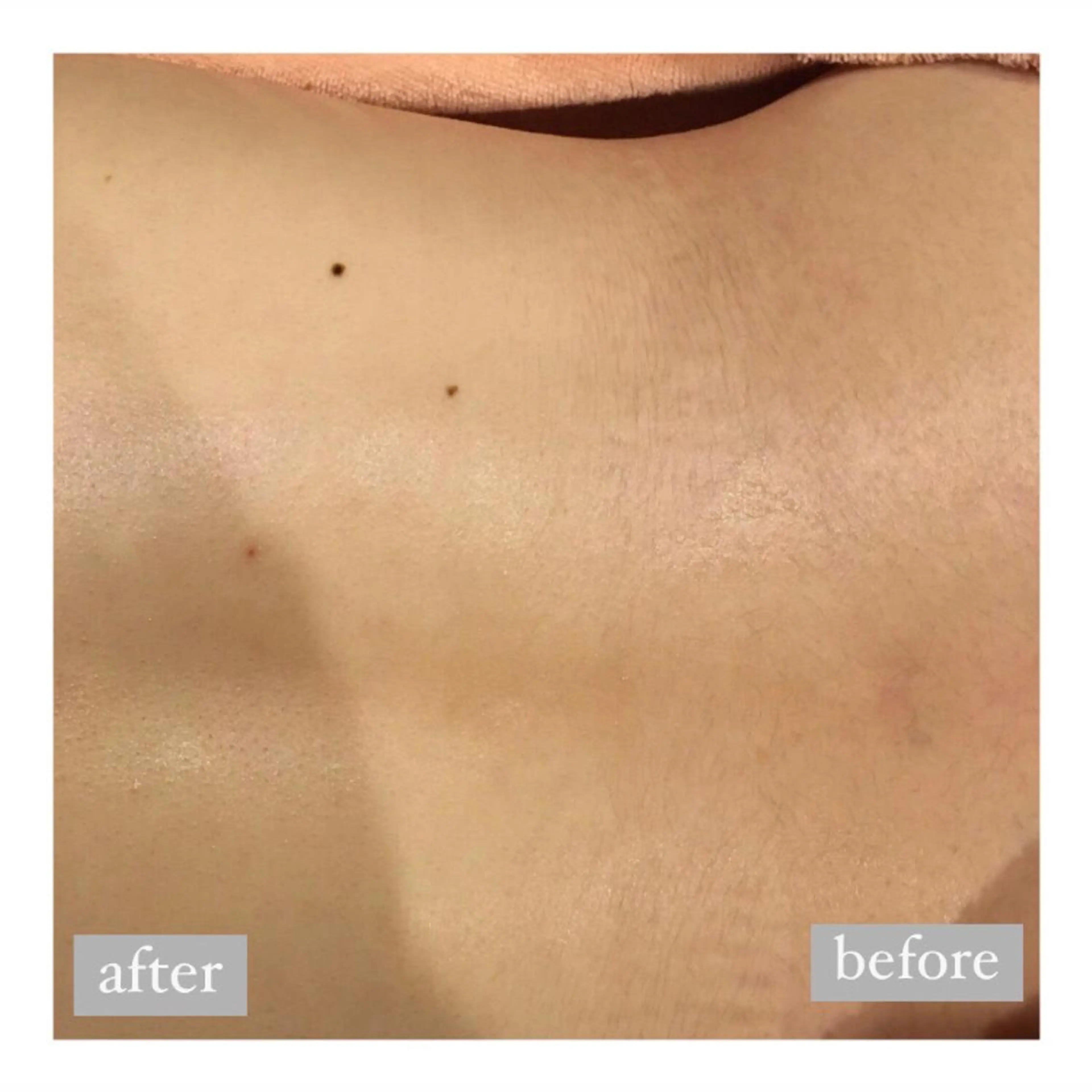 美肌脱毛専門サロン Dione栄店のエステ・リラクイメージ