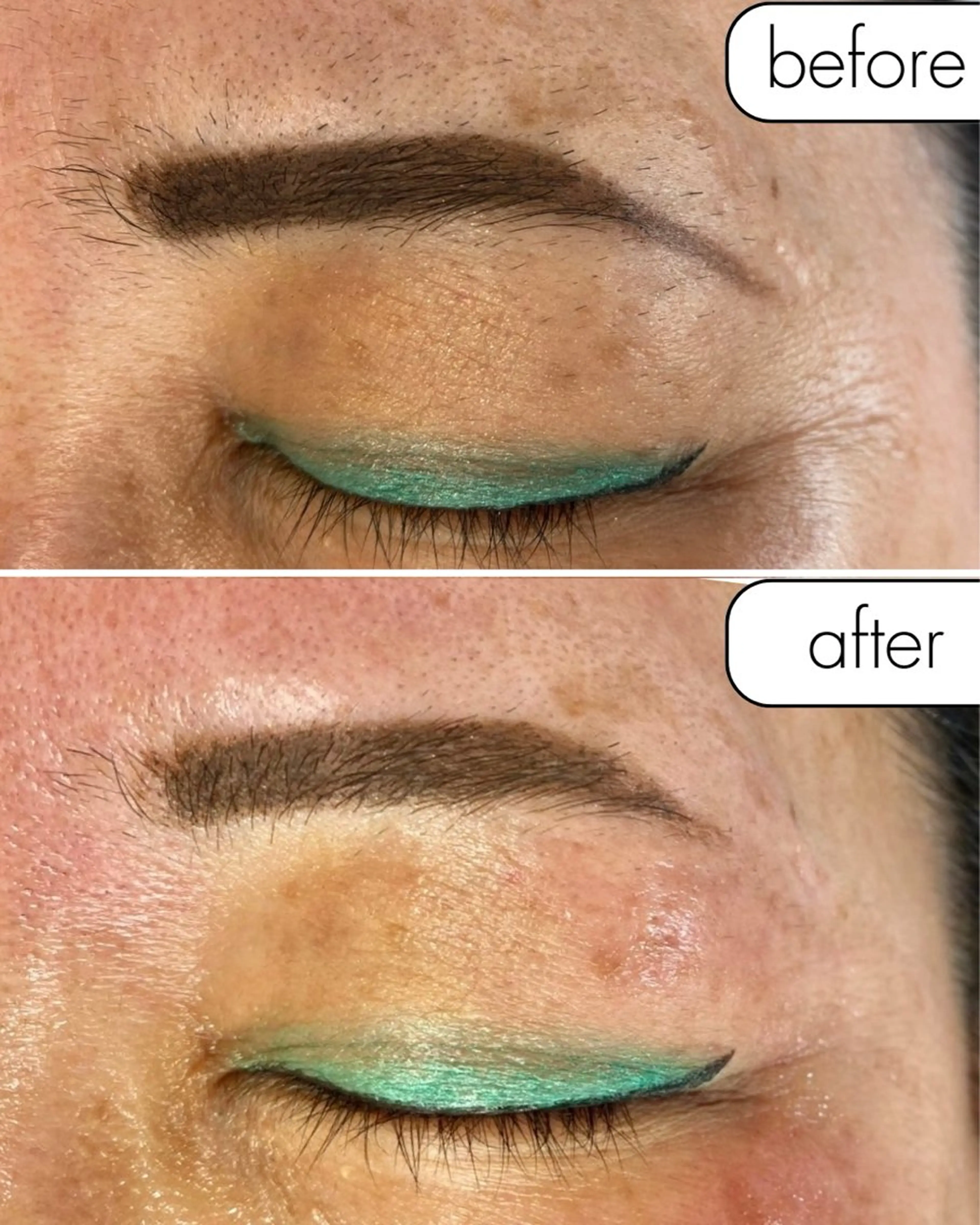 脱毛 蝶式糸除毛専門salon aco所属・糸除毛専門salon acoのエステ・リラクイメージ