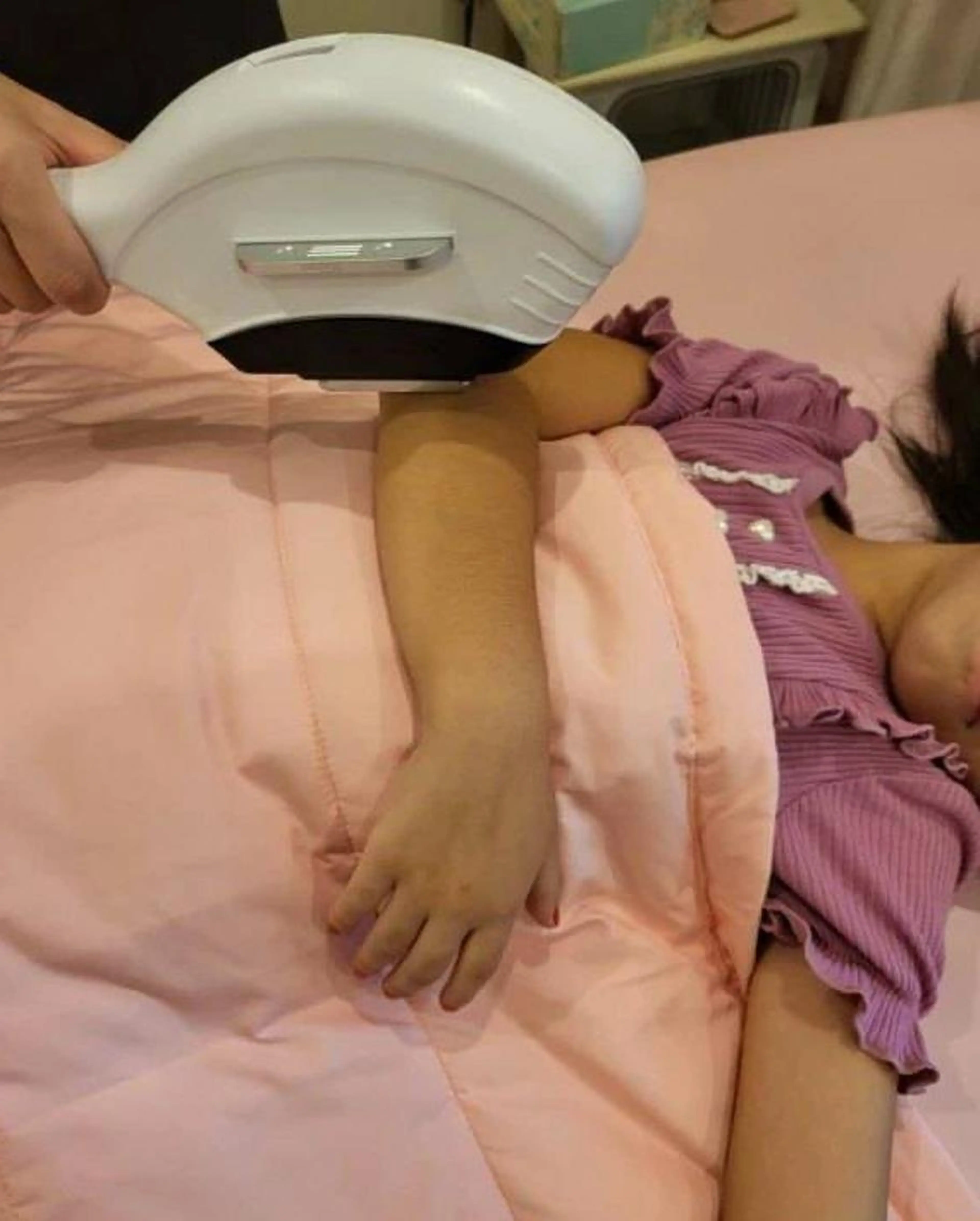 ❝キッズ❞ひじ下脱毛の写真