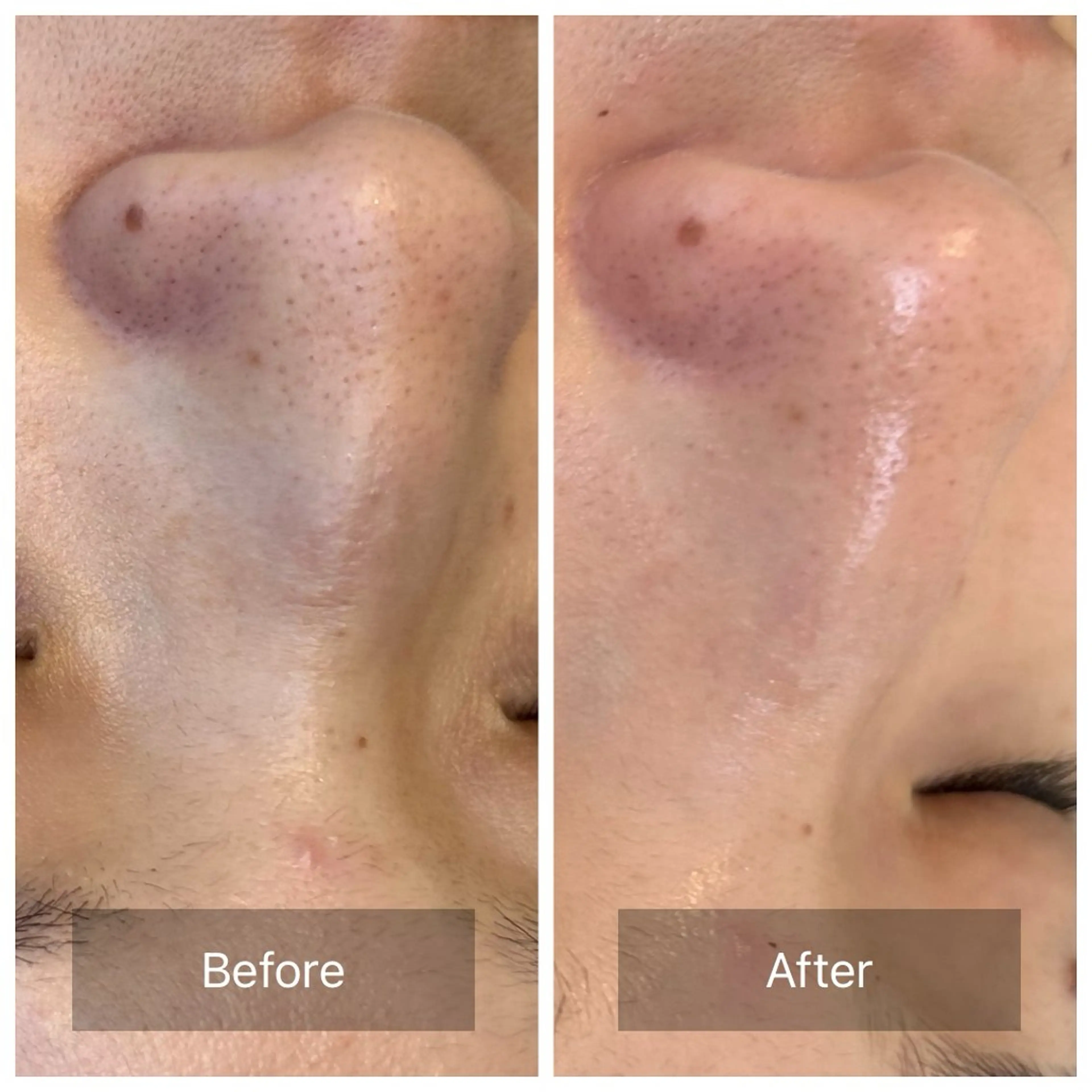 エステ リラク 美肌改善/毛穴/シミ サントゥールのエステ・リラクイメージ