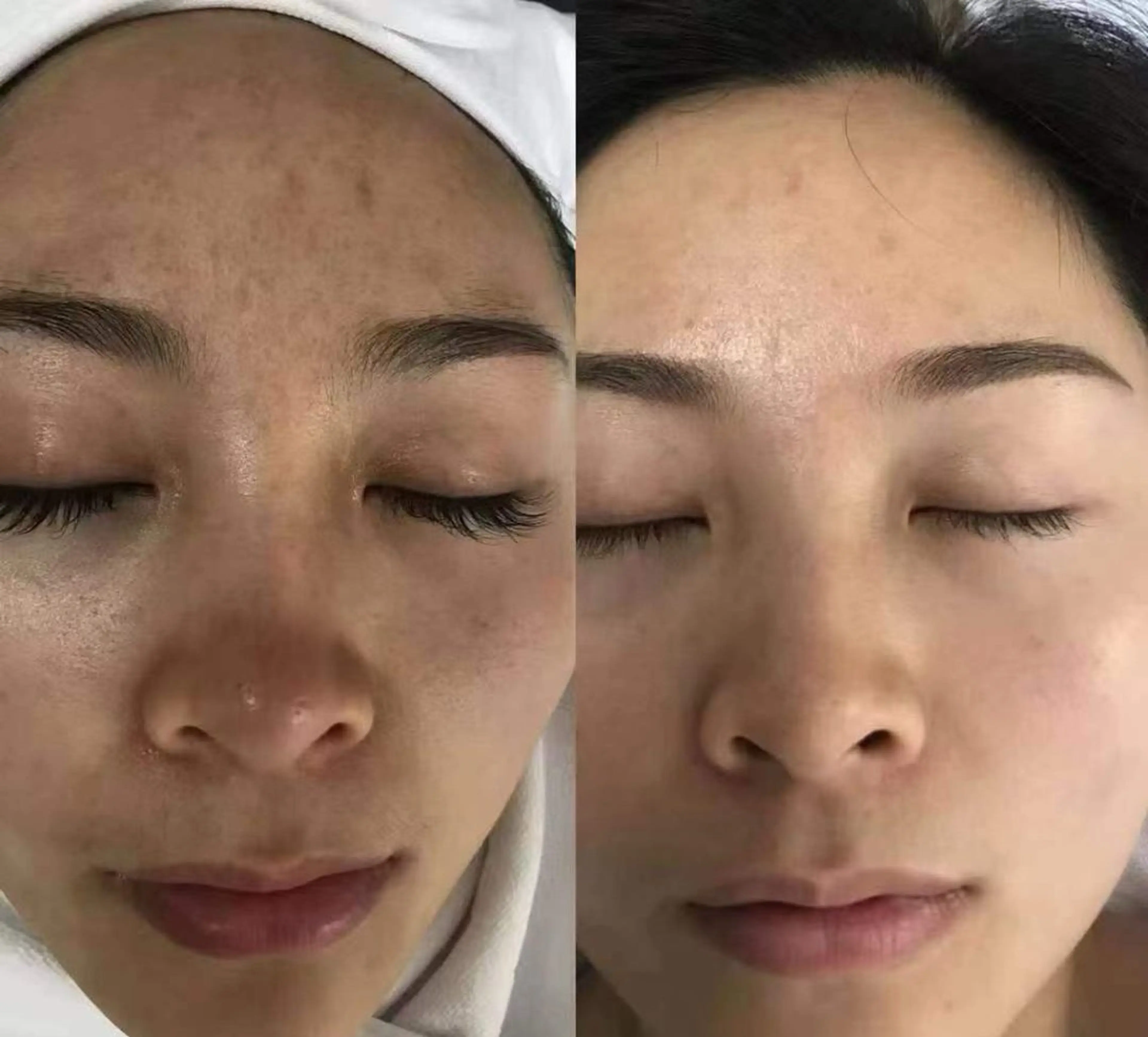 ネイル aliaハイフ&水光ジェットサロン所属・aliaハーブ水光店 エステティシャン募集のエステ・リラクイメージ