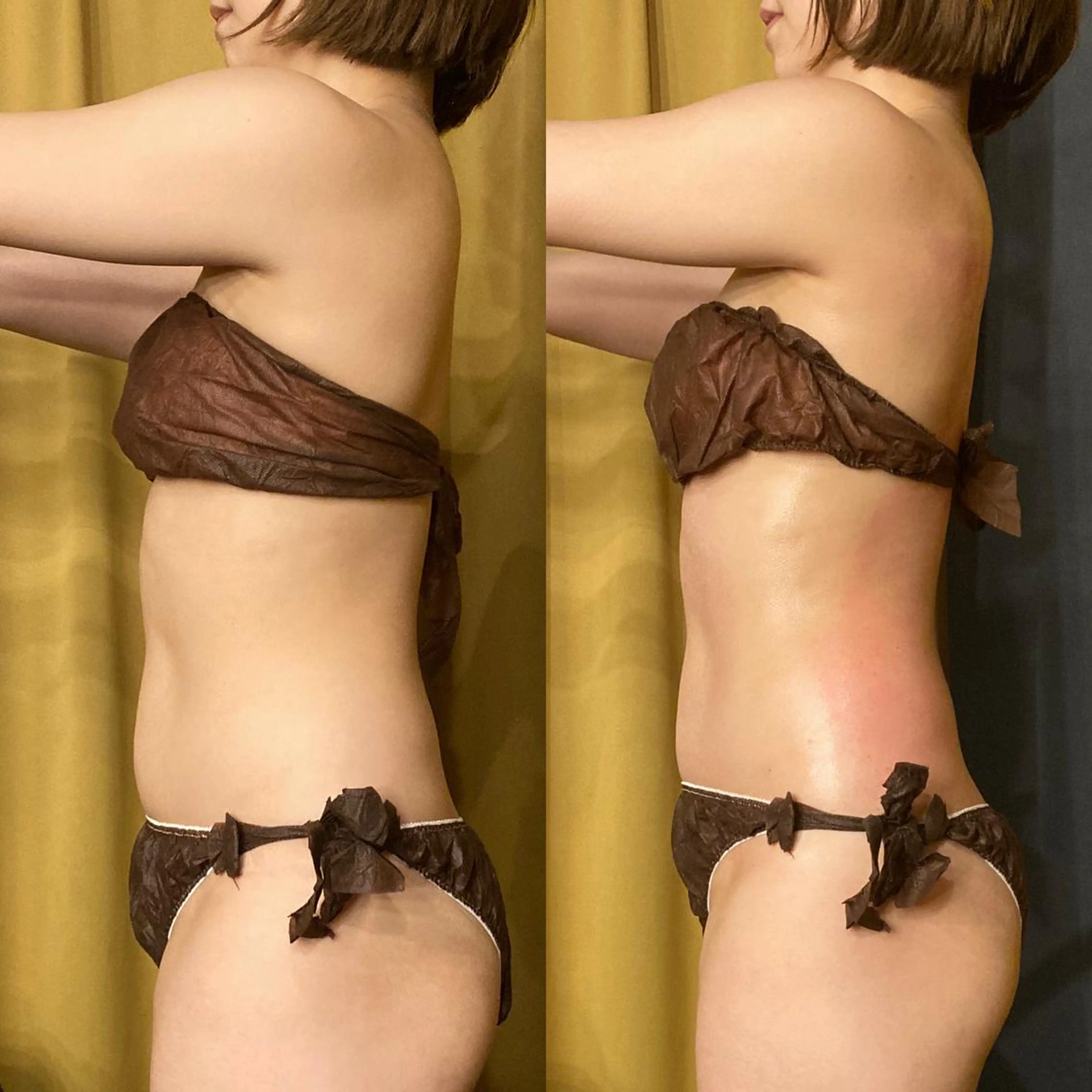 小顔やたるみに特化 💚野瀬可蓮のその他イメージ