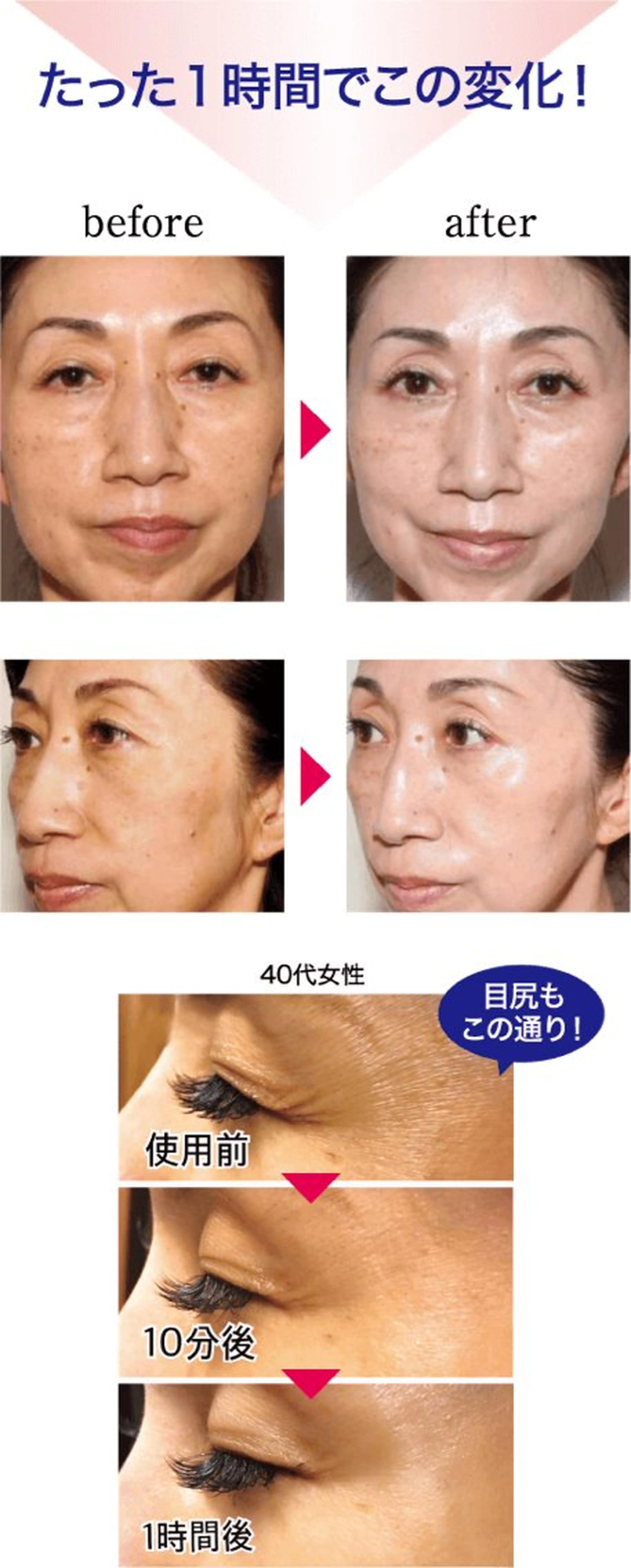 ハーブピーリング専門 毛穴洗浄❤️眉waxのエステ・リラクイメージ