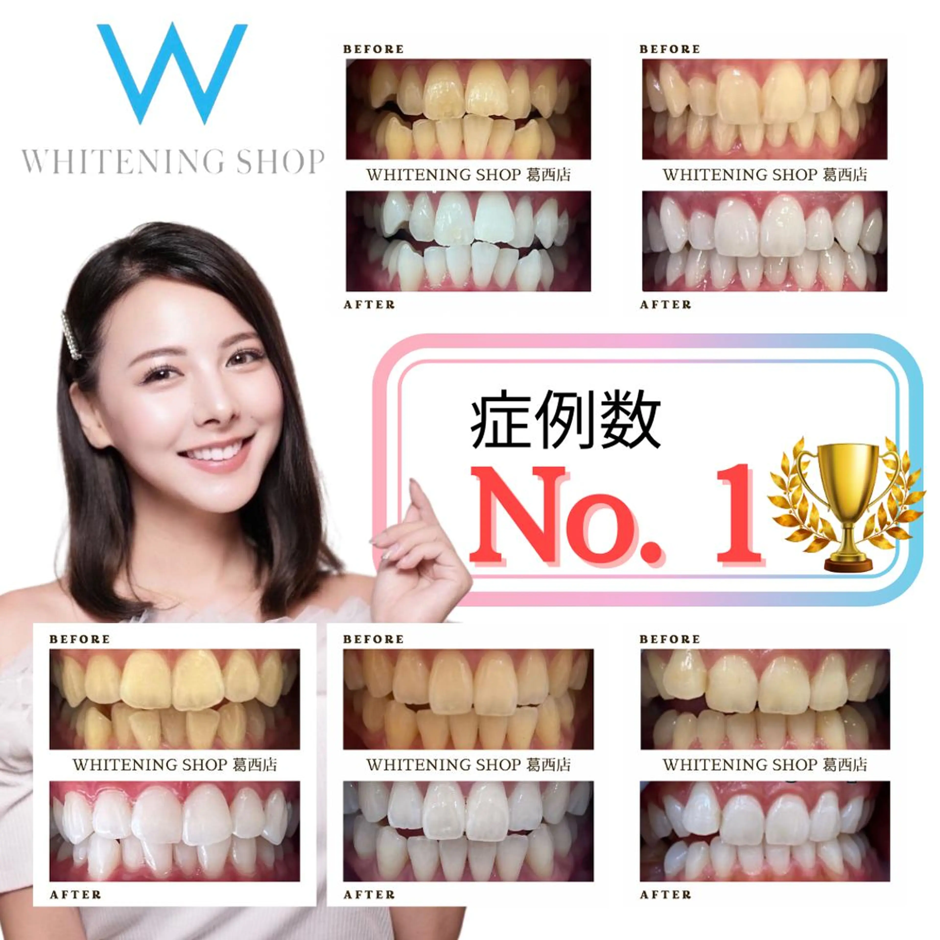 メンズ その他 ホワイトニング ショップ葛西店のその他イメージ