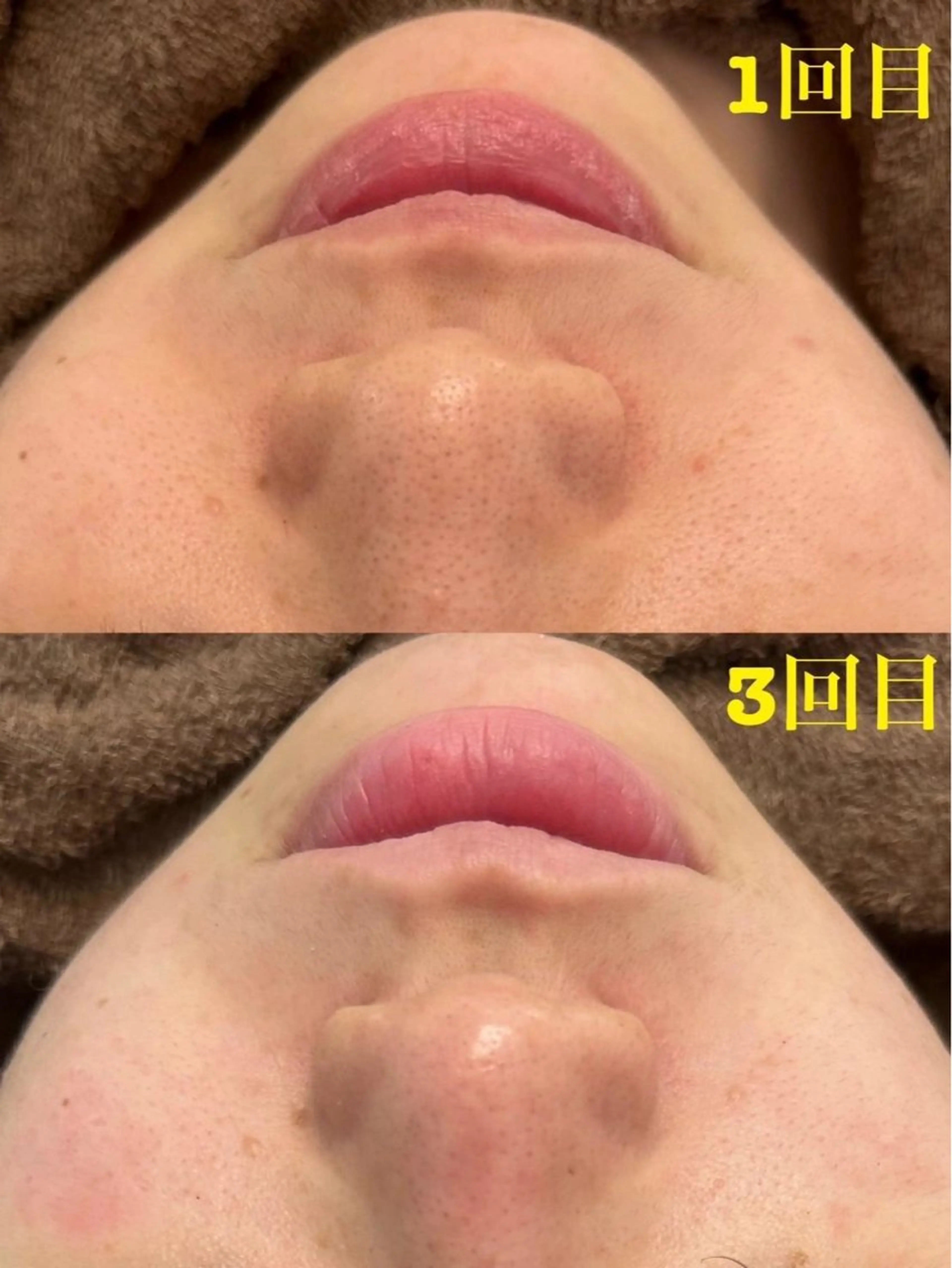 エステ 韓国肌管理 Belle 川越店のエステ・リラクイメージ