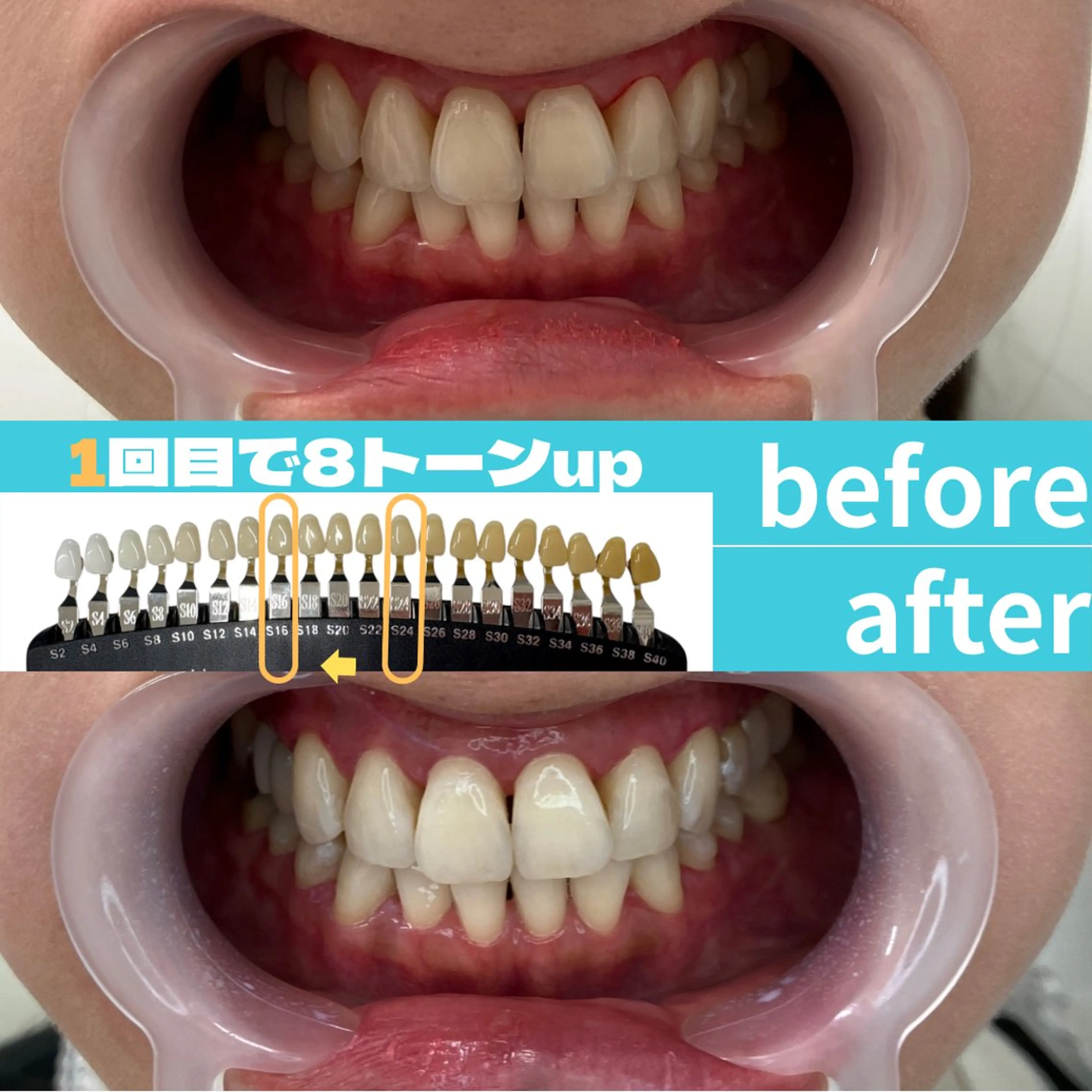 エステ s rikoのエステ・リラクイメージ