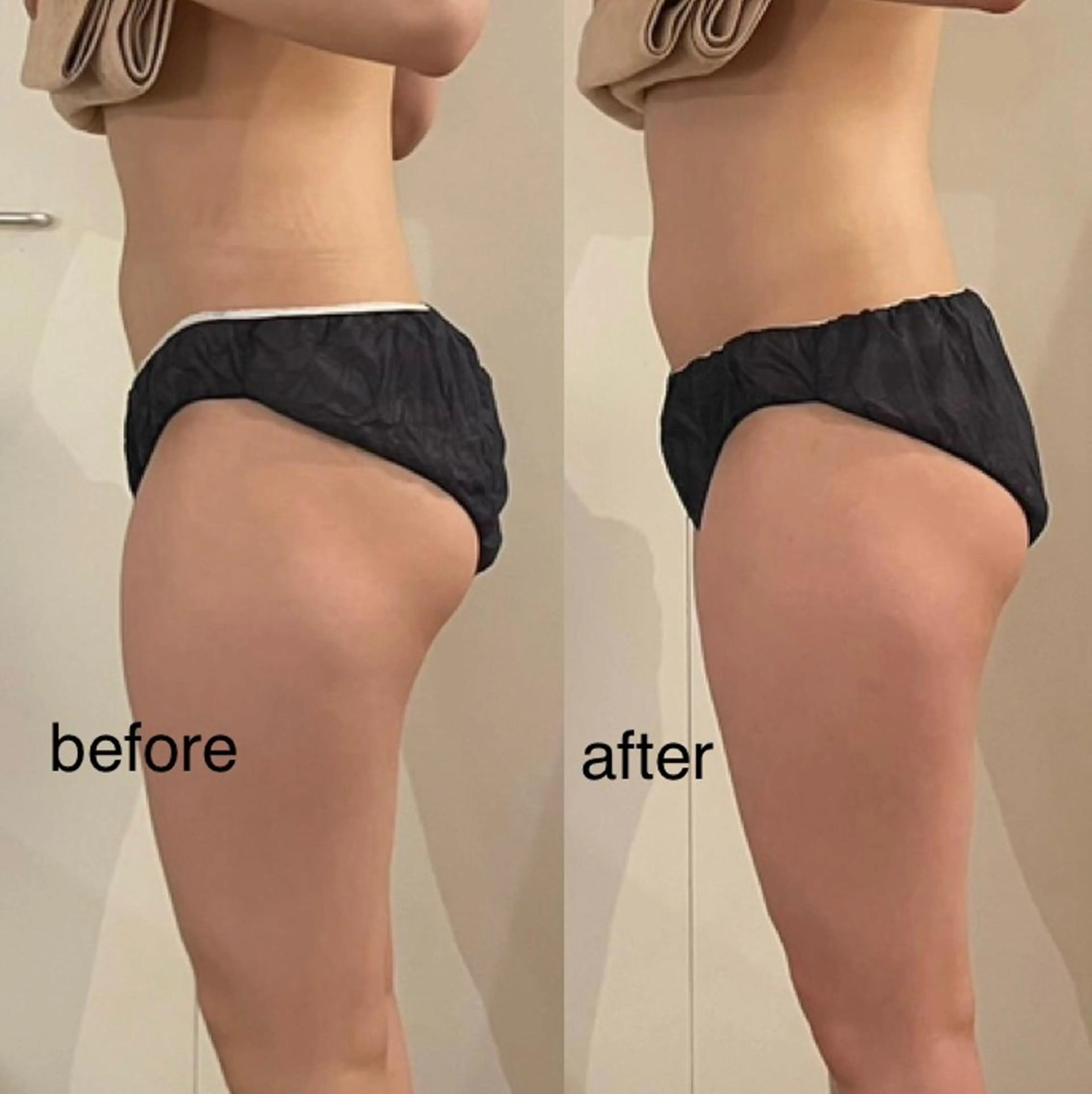 エステ リラク プライベートサロン シュシュのエステ・リラクイメージ