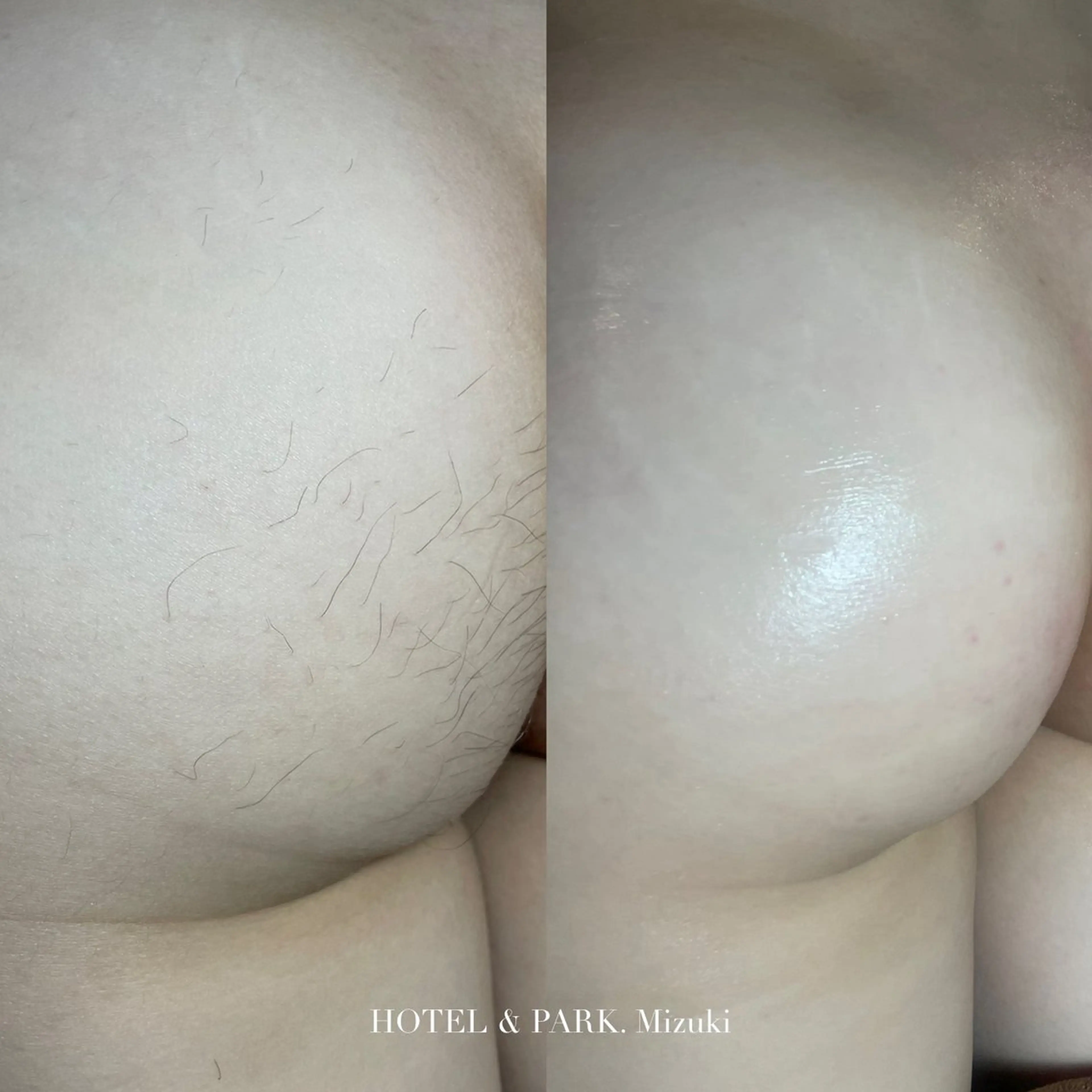 HOTEL&PARK . ワックス脱毛のエステ・リラクイメージ